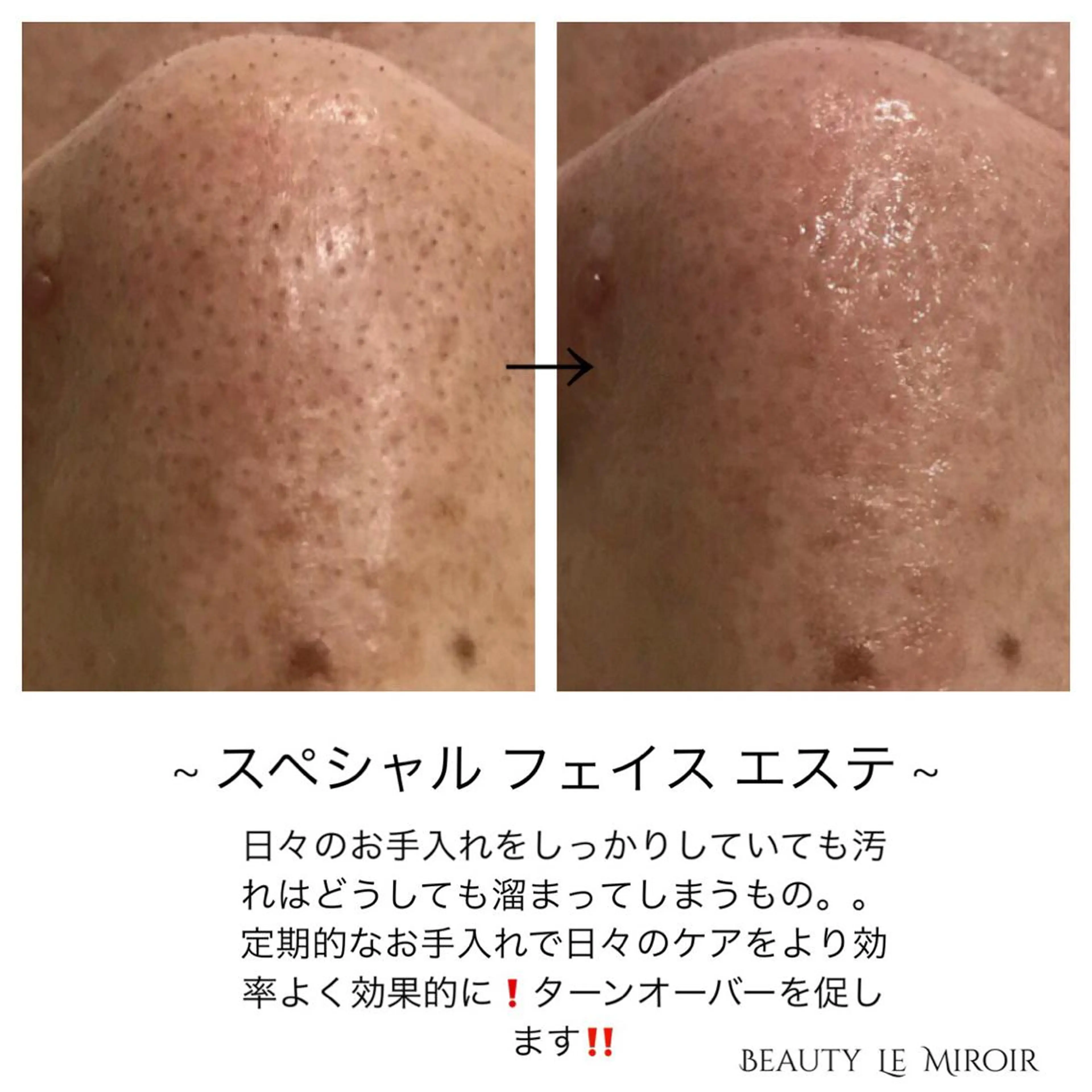 ビューティー ミロワールのエステ・リラクイメージ