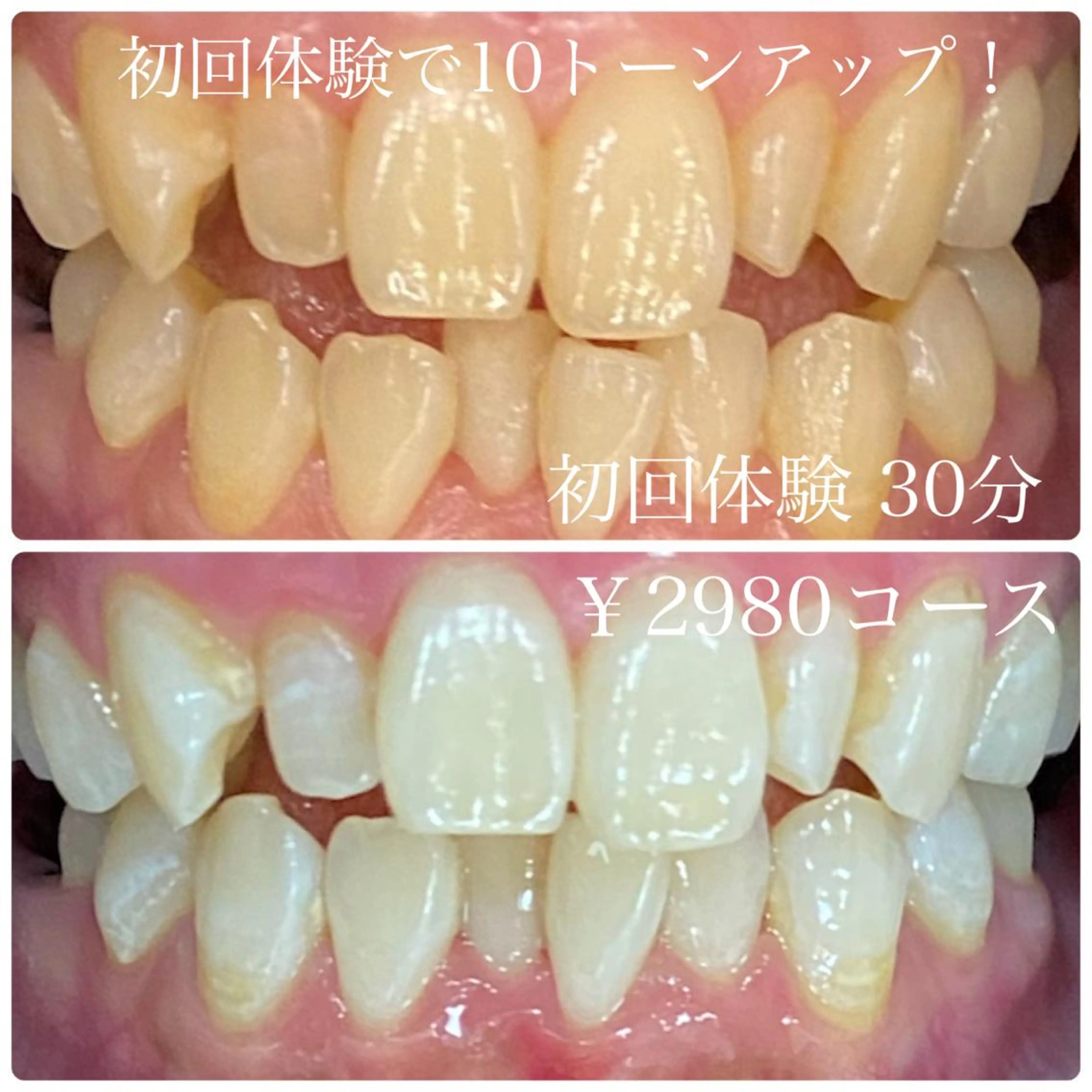 ホワイトニング ルーム　川崎店のその他イメージ