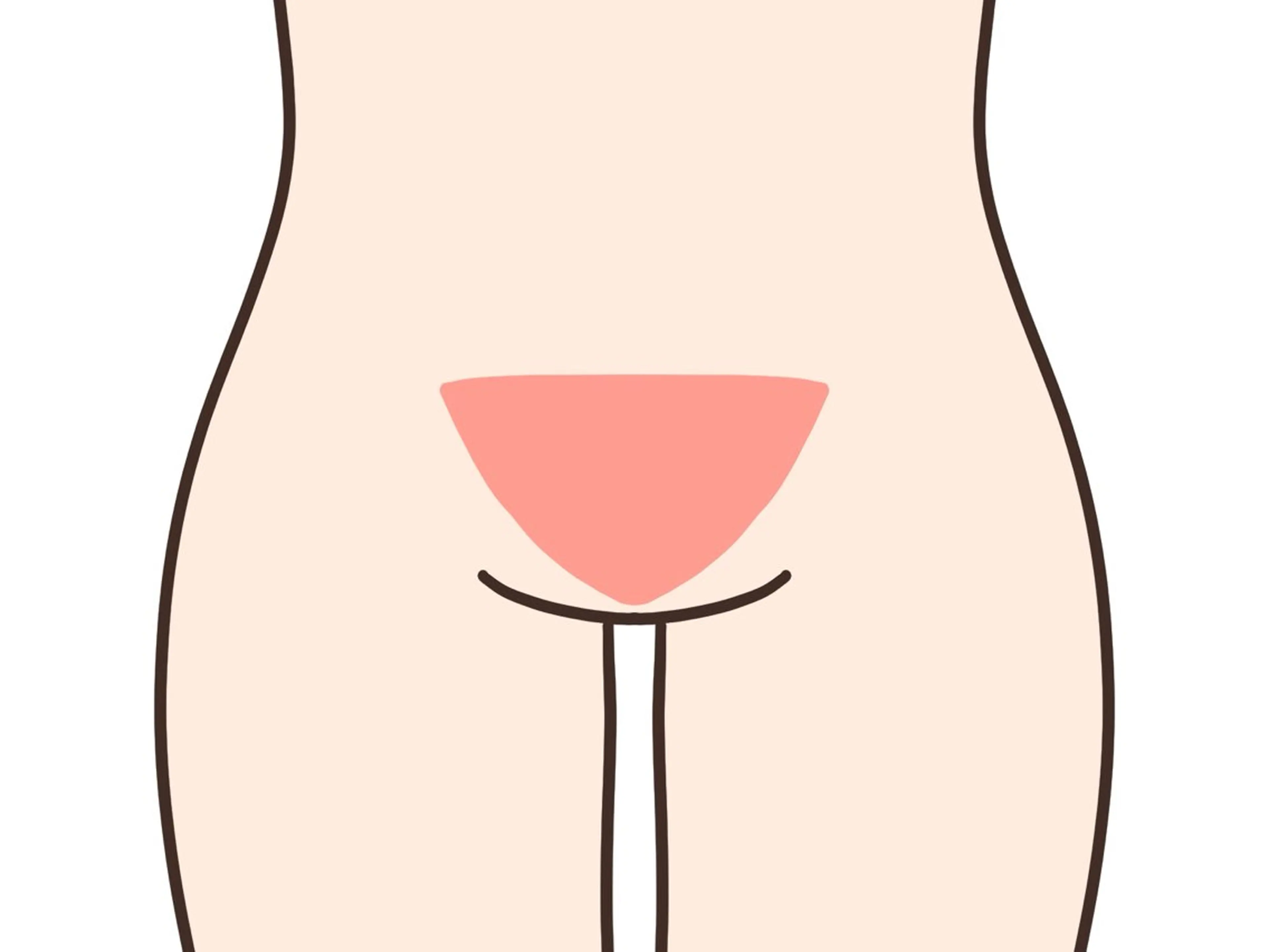 【レディース】VIO選べる部位ワックス脱毛『V』/はみ毛防止・デザイン可能！毛量により割引き制度あり◎の写真