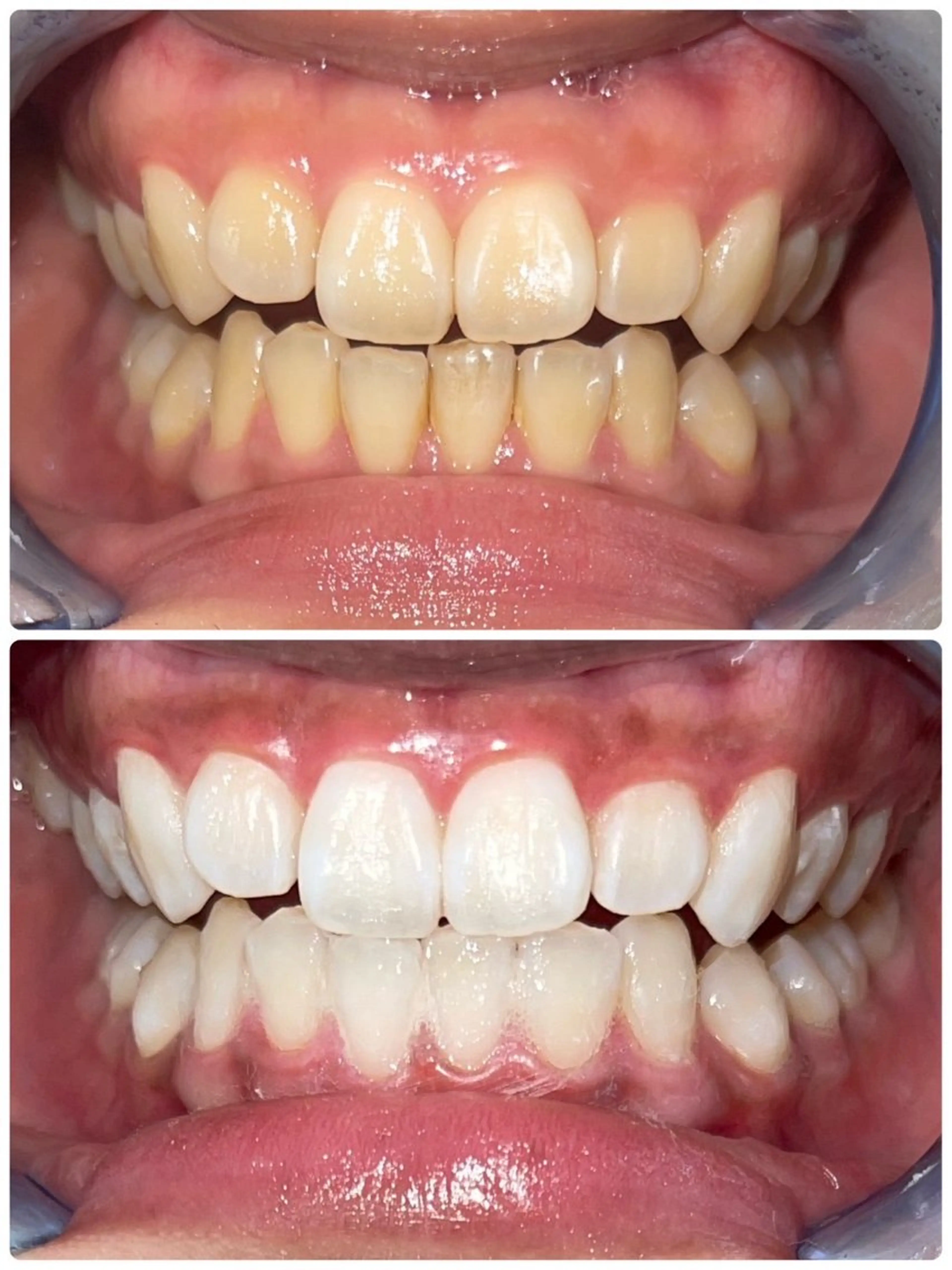 セルフホワイトニング エクシア徳島店マユのその他イメージ