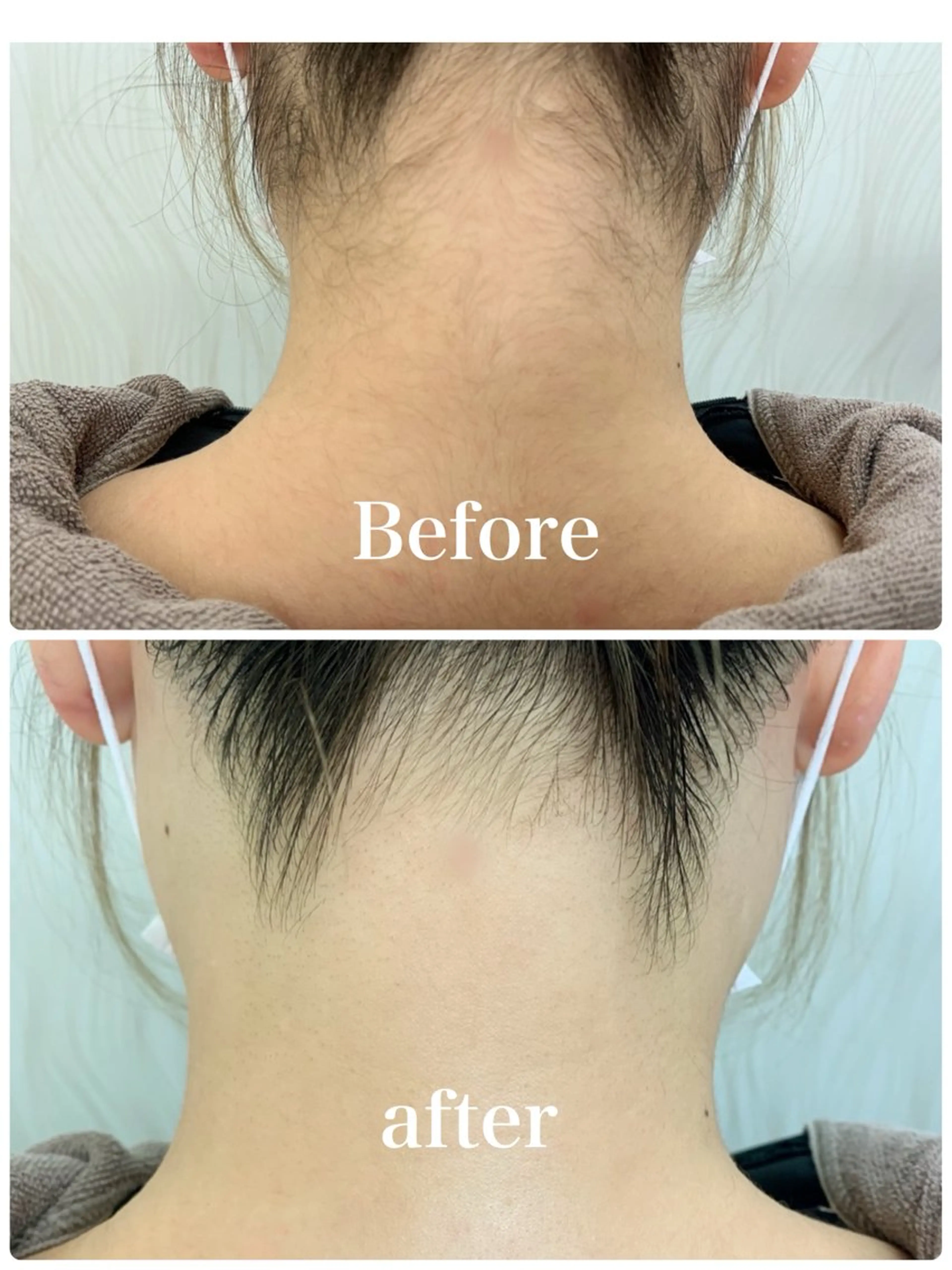 襟足デザインシェービングの写真