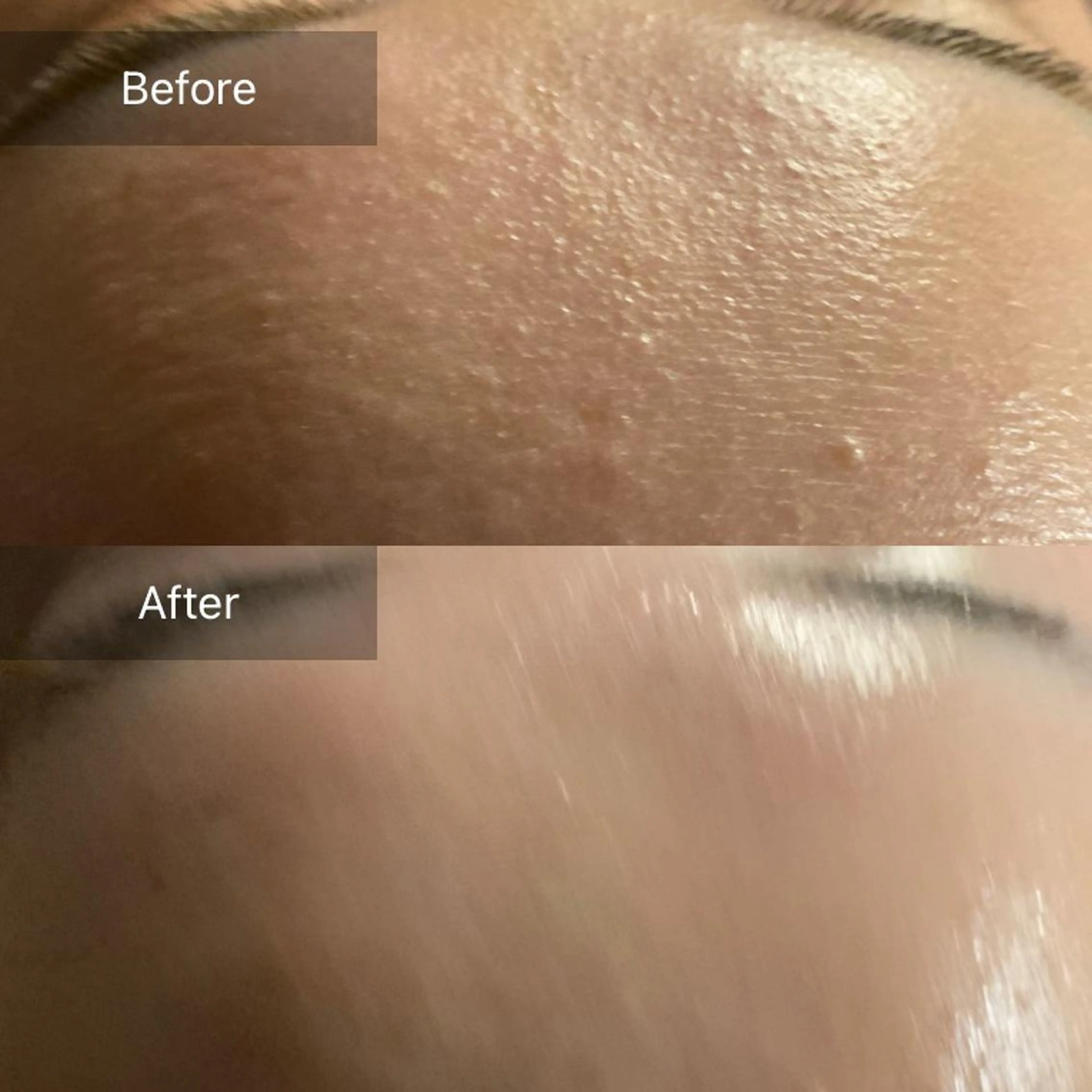 Mandarin Orange所属・毛穴から始める肌メン テマンダリンオレンジのエステ・リラクイメージ