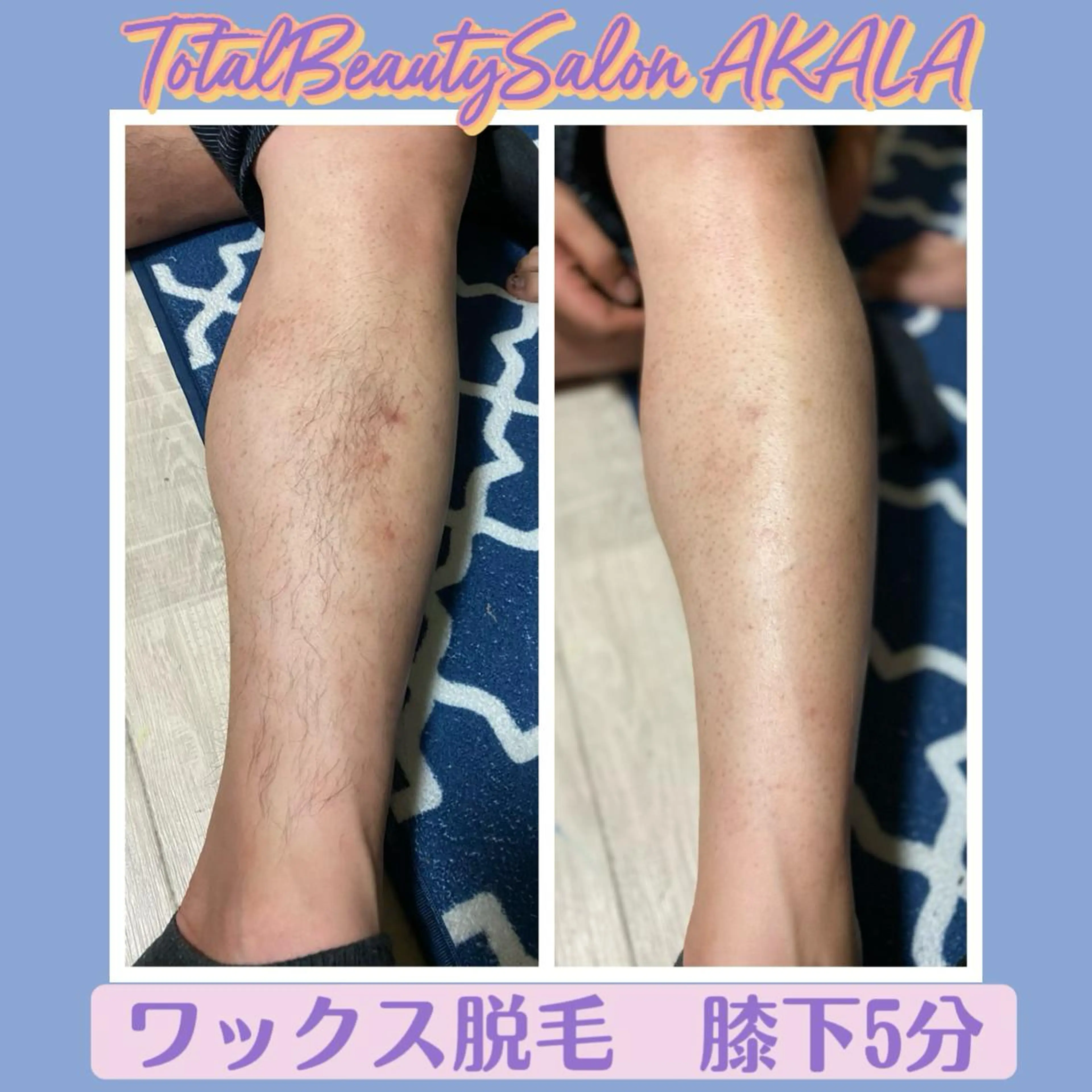 AKALA エステ リンパマッサージのエステ・リラクイメージ