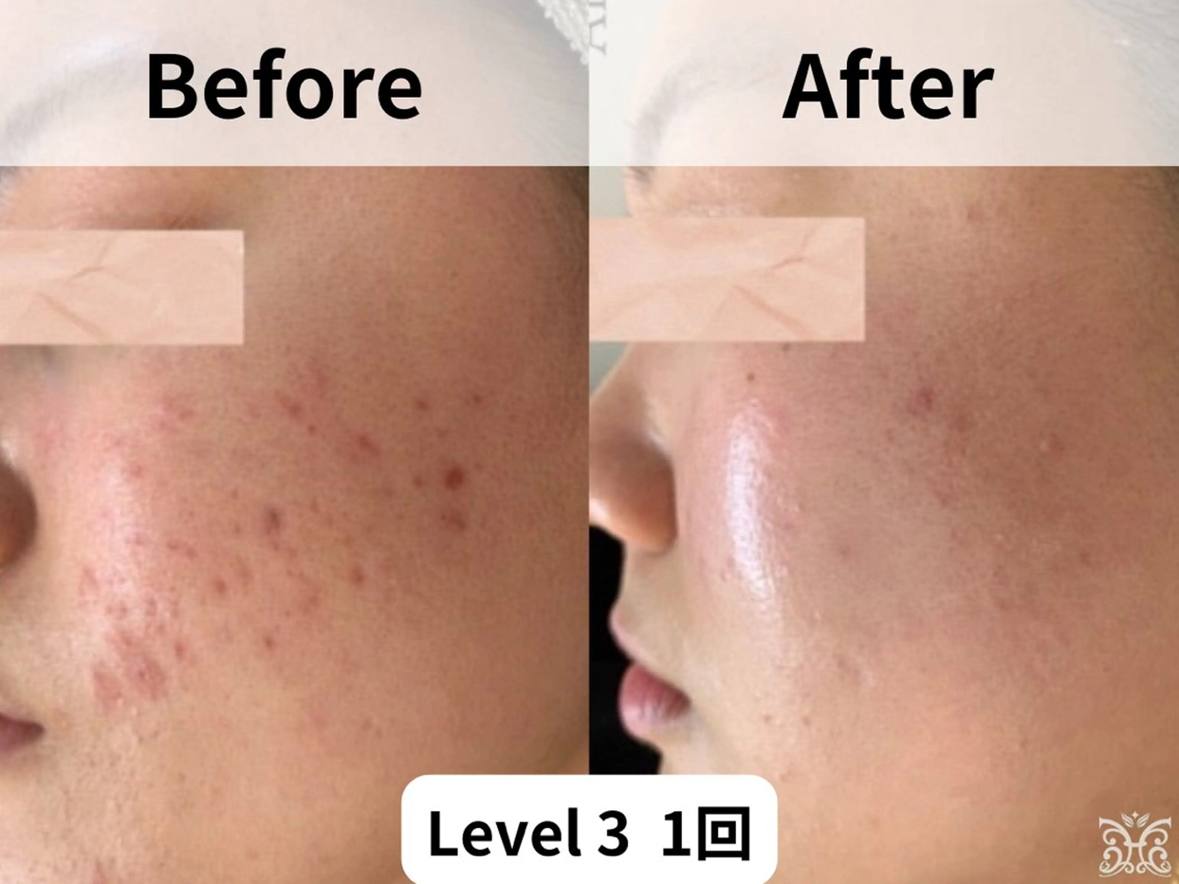 美肌&アロマ🌸 nana 中目黒のエステ・リラクイメージ