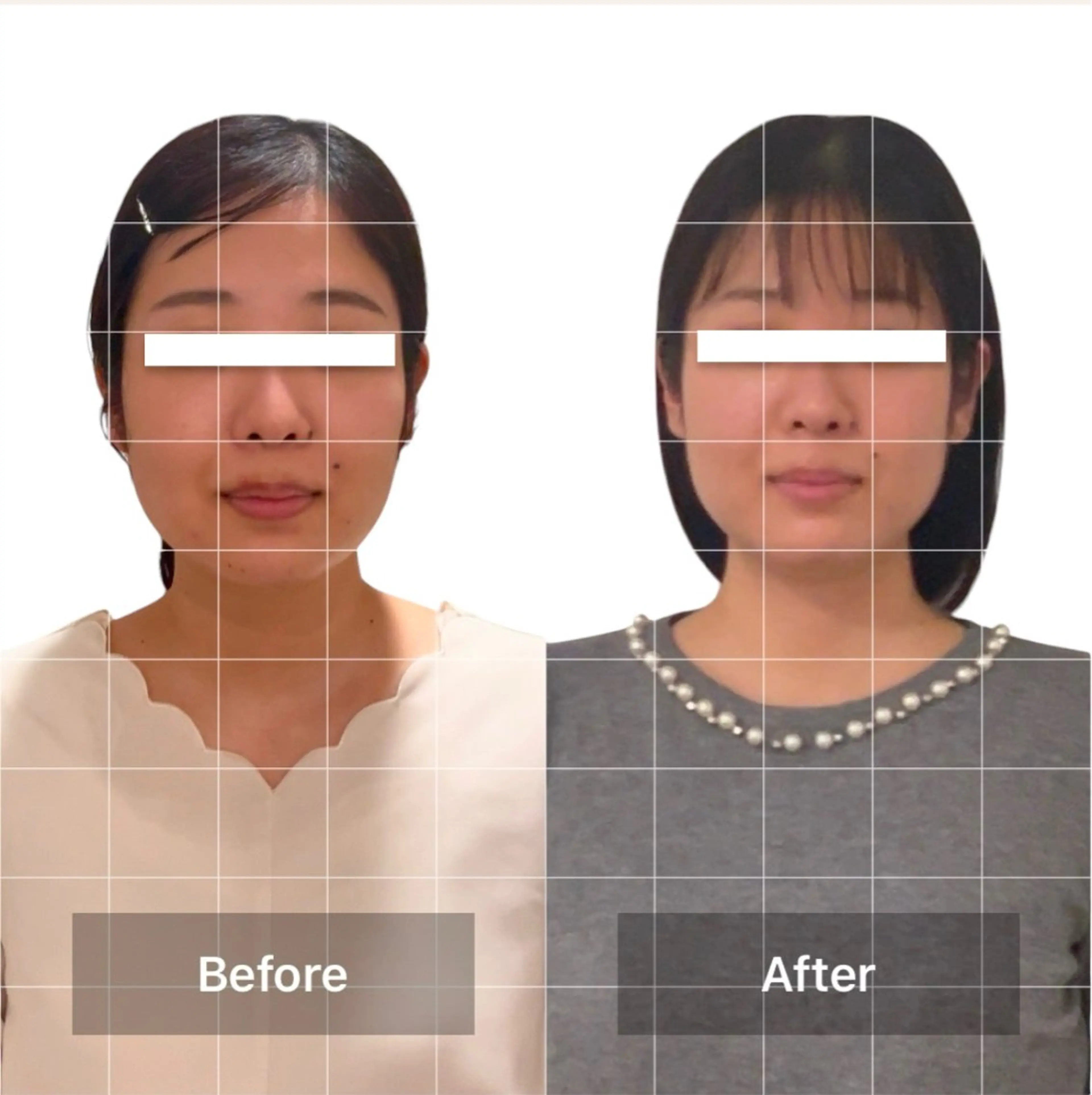 エクラヴィ 小顔・エイジングケアのエステ・リラクイメージ