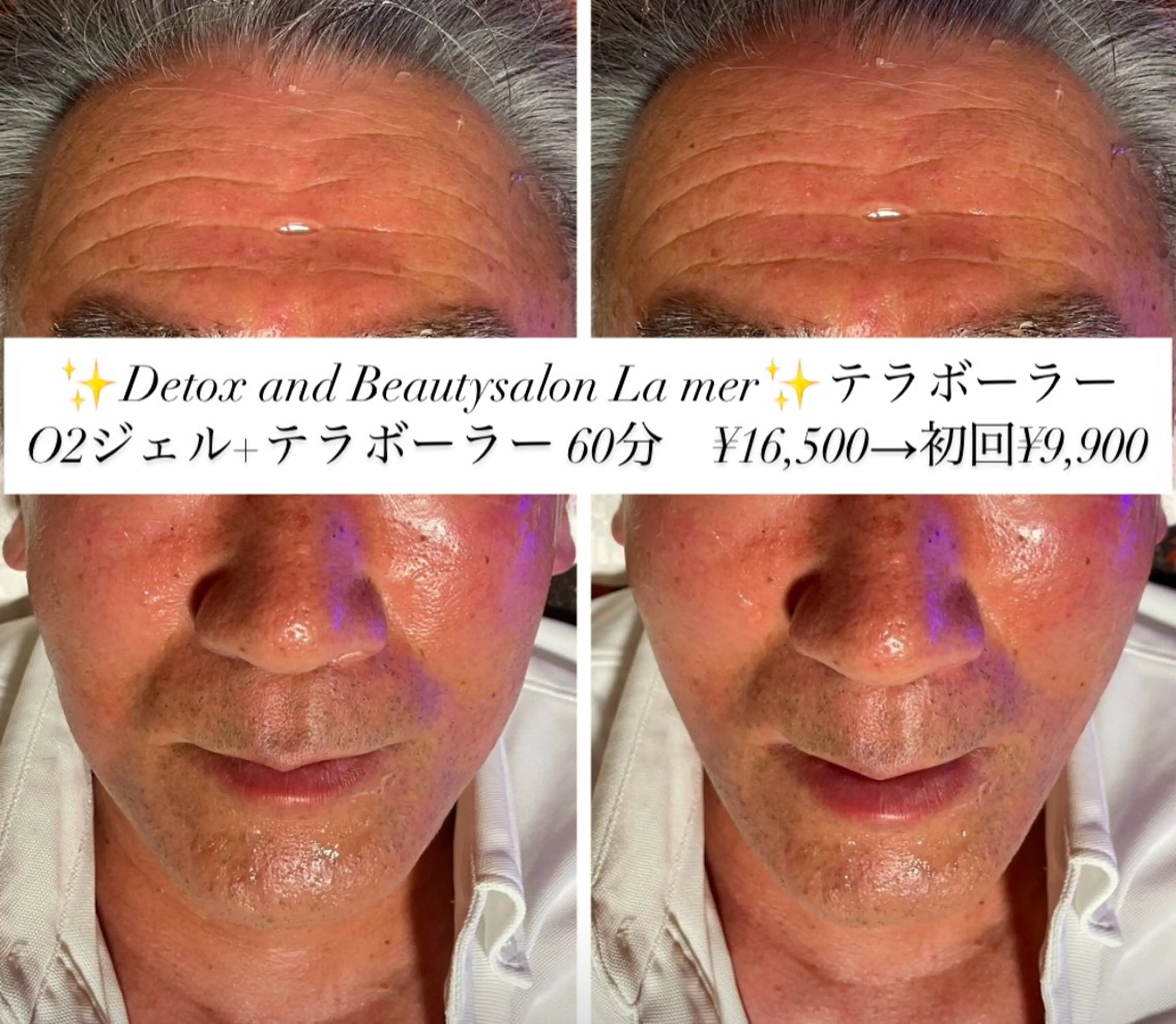 エステ 耳ツボ/体質改善/ 温活La mer月島のその他イメージ