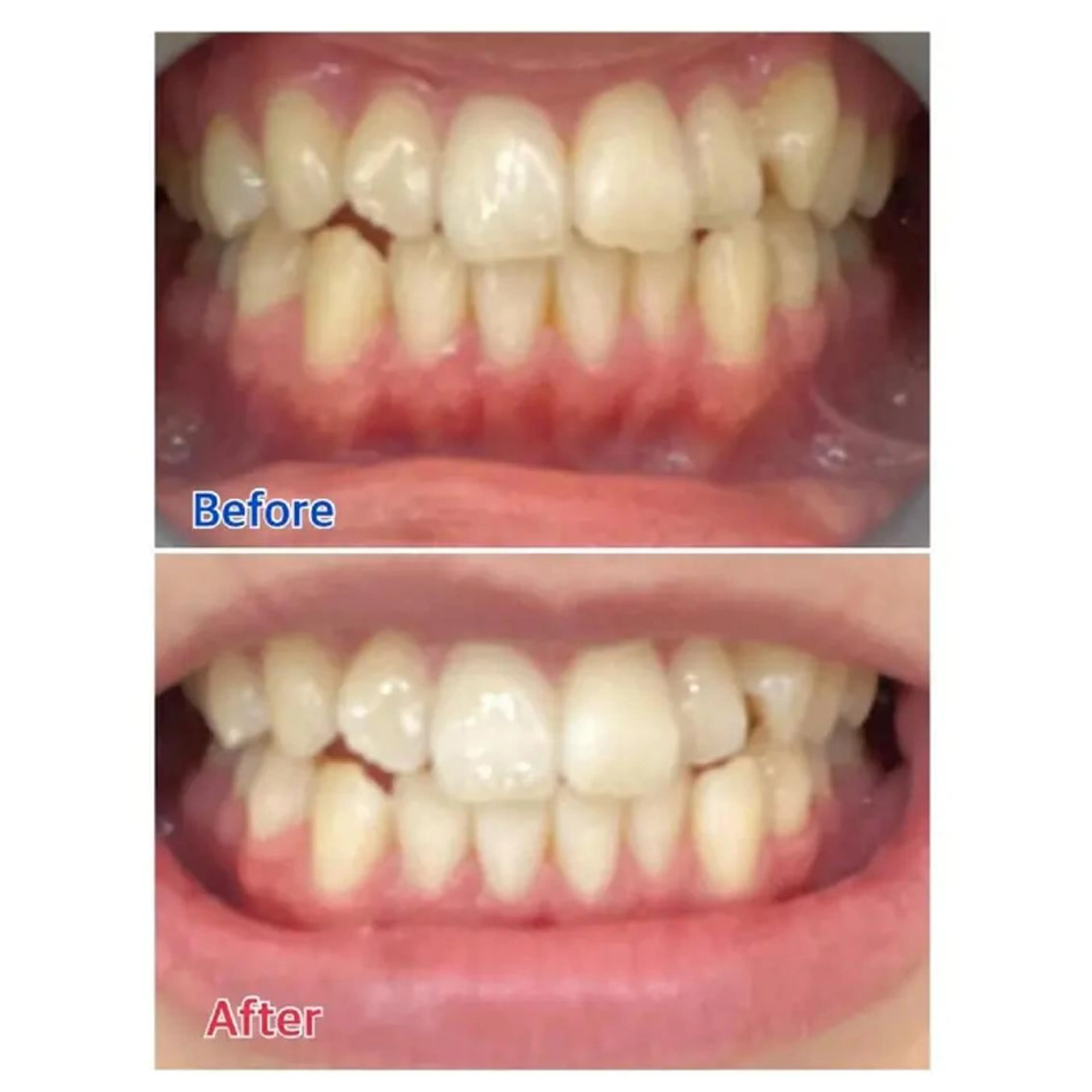 M渋谷 ホワイトニングのエステ・リラクイメージ