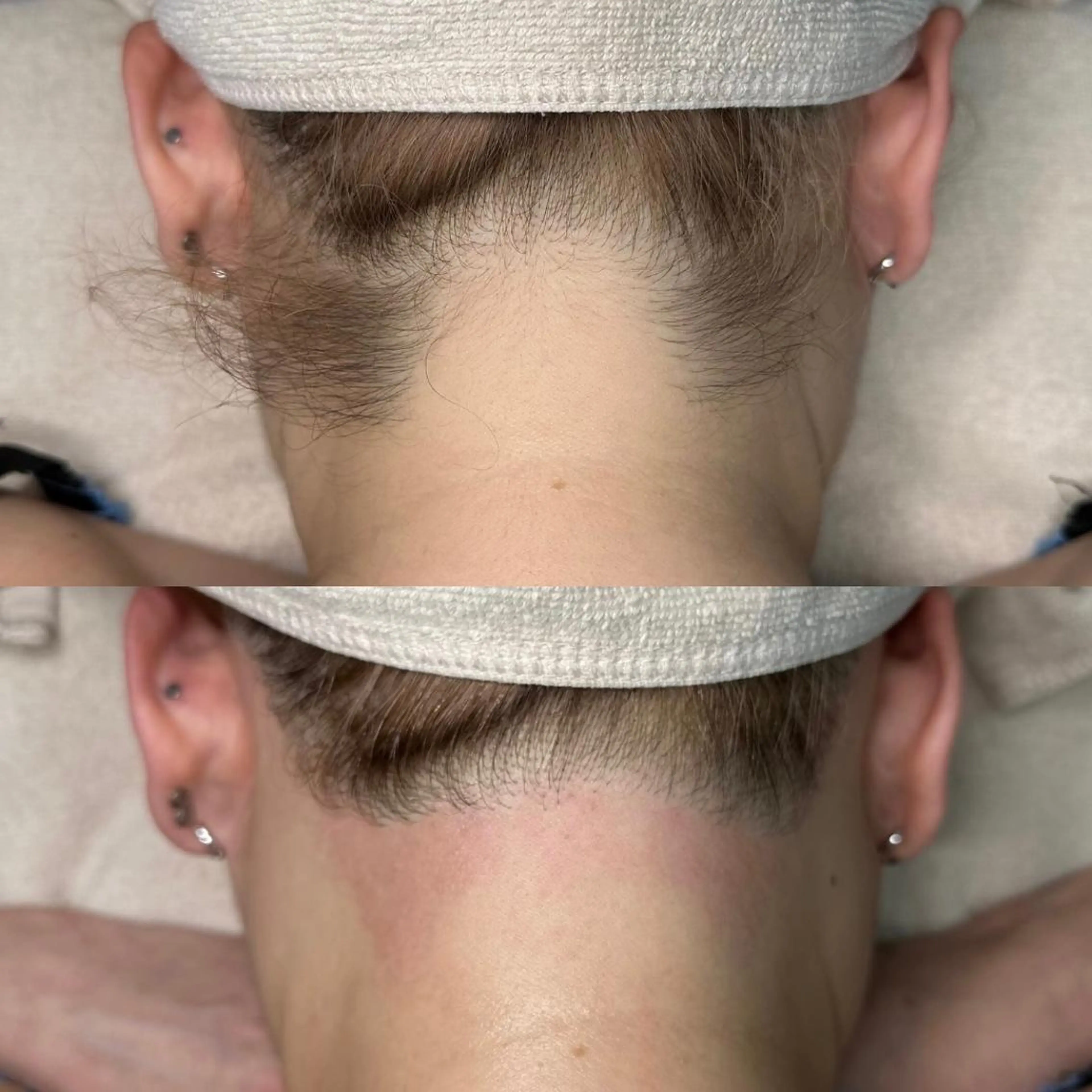 セミロング ヘアアレンジ WAX&光脱毛 ESTHERIAのエステ・リラクイメージ