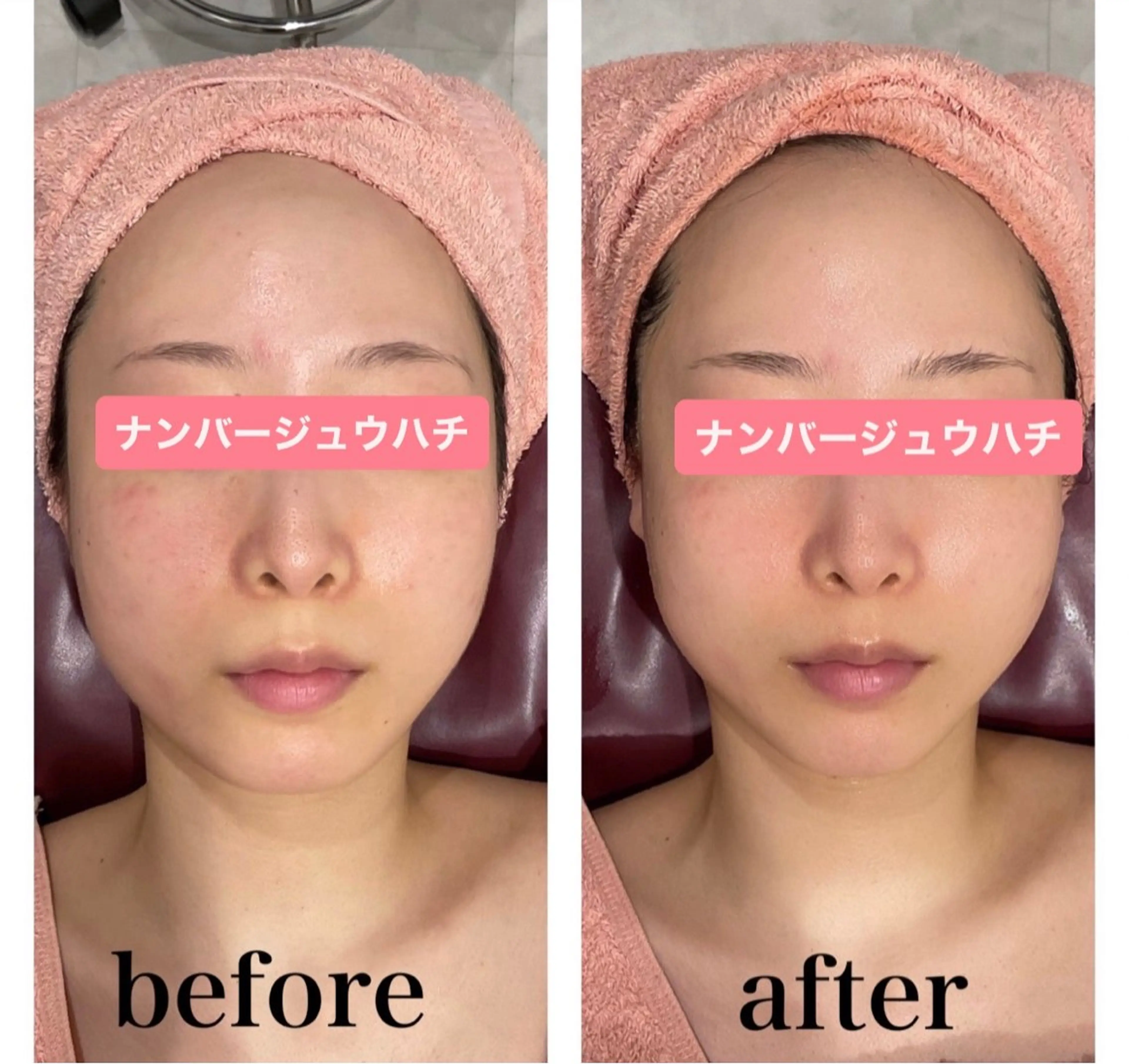 エステ リラク 韓国肌管理ララピール 小顔リフト/LDMのエステ・リラクイメージ