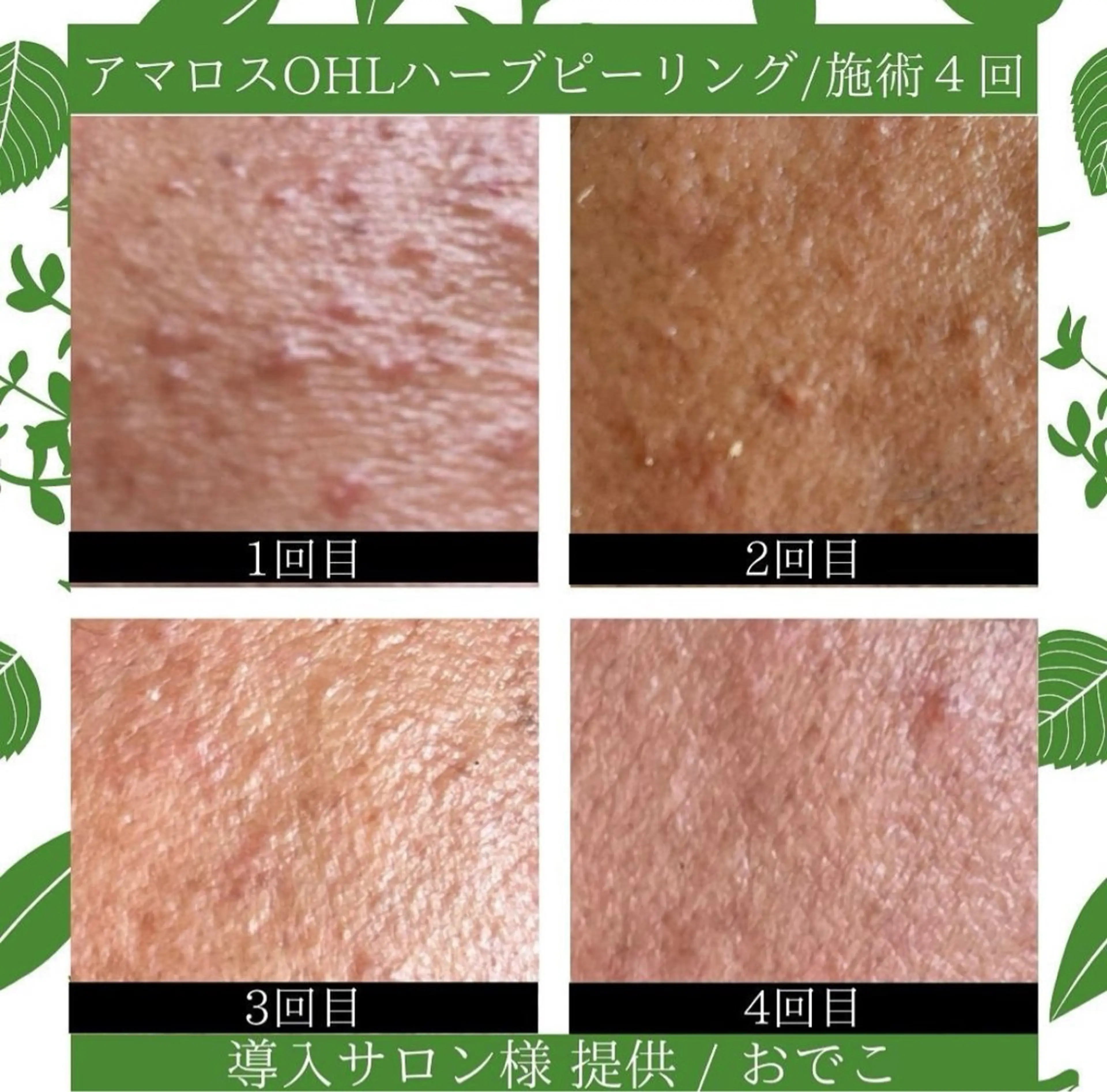 LiAm《美肌管理/ 小顔/脂肪ケア》のその他イメージ