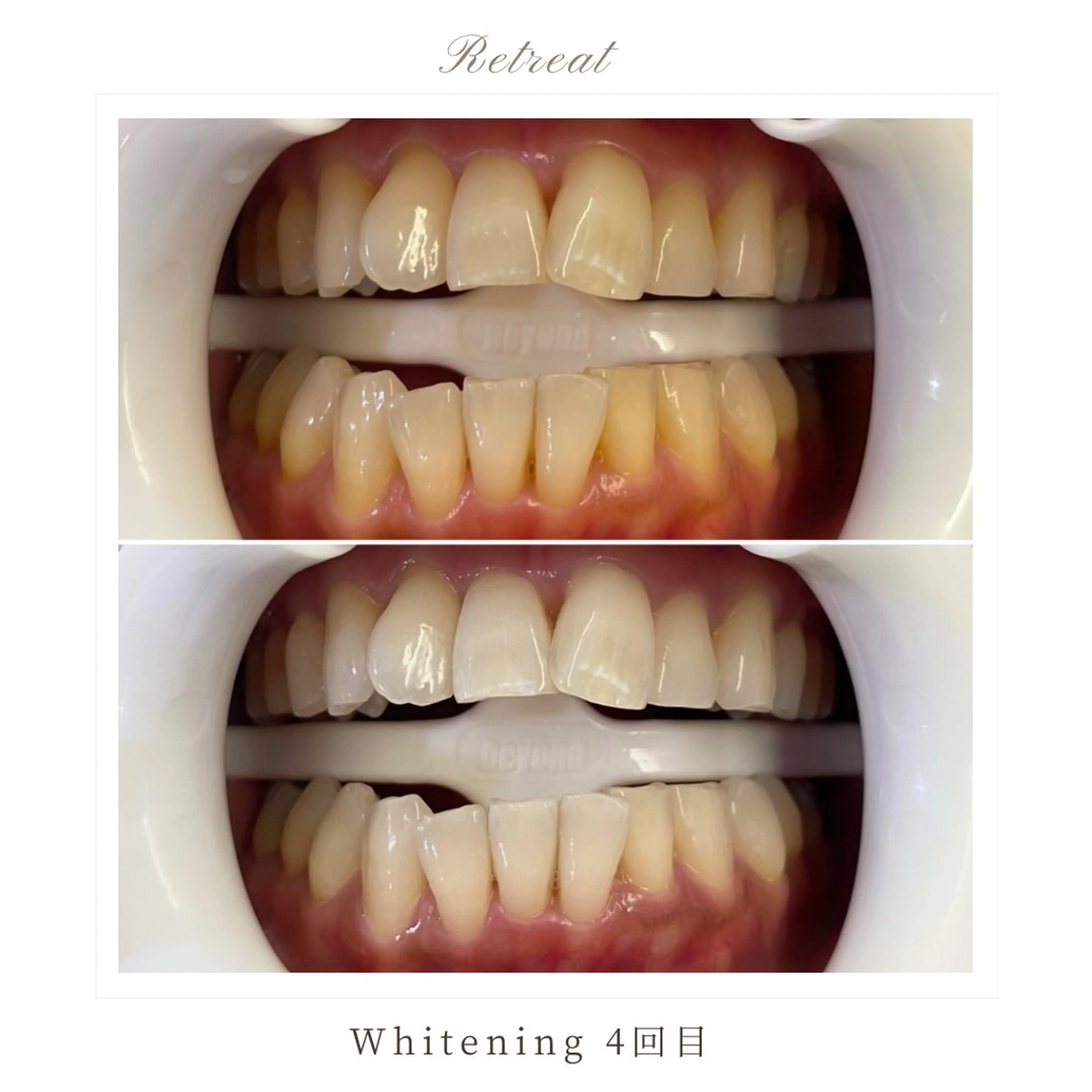 歯科医院提携 Retreatのエステ・リラクイメージ