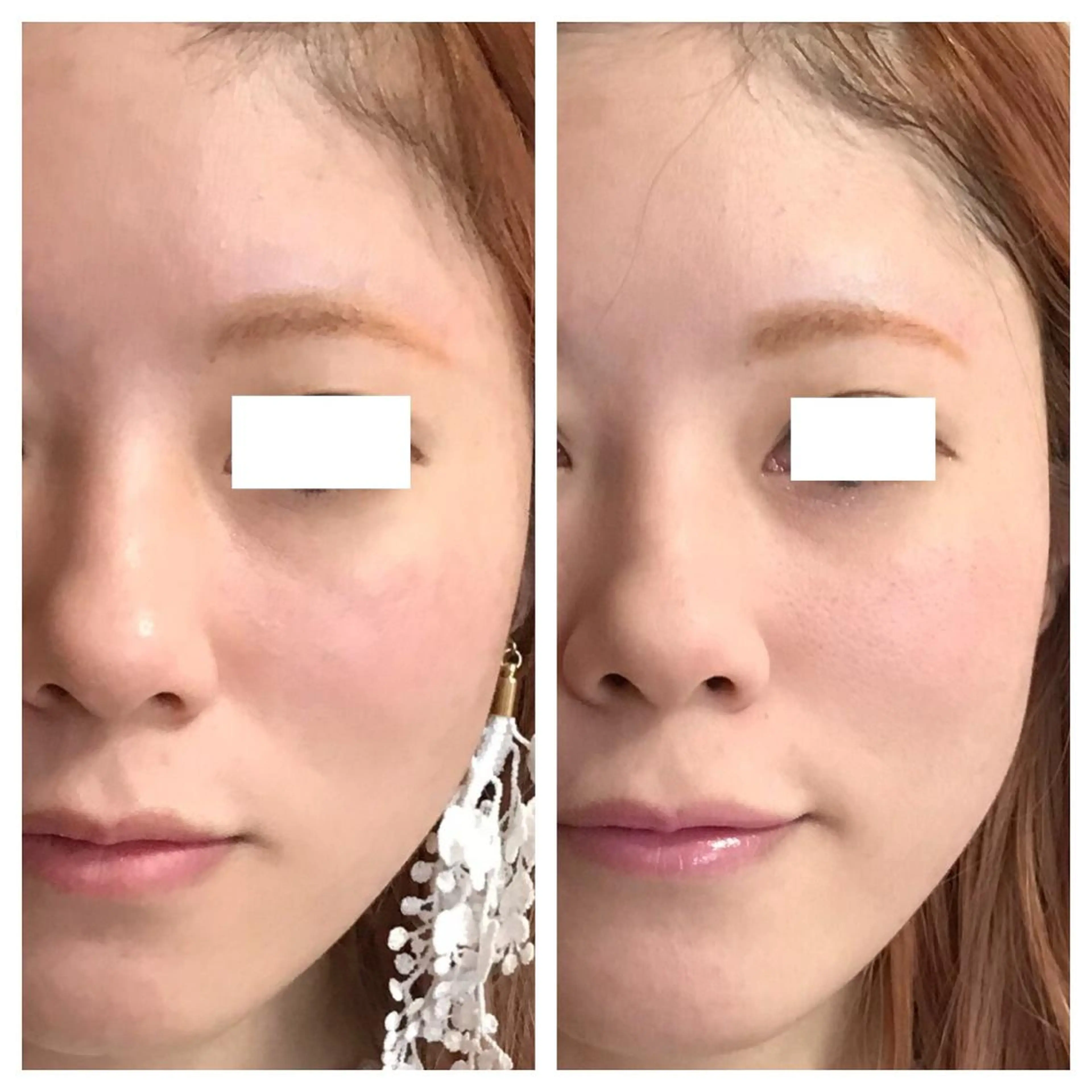 エステ 酒井 瑠未のエステ・リラクイメージ