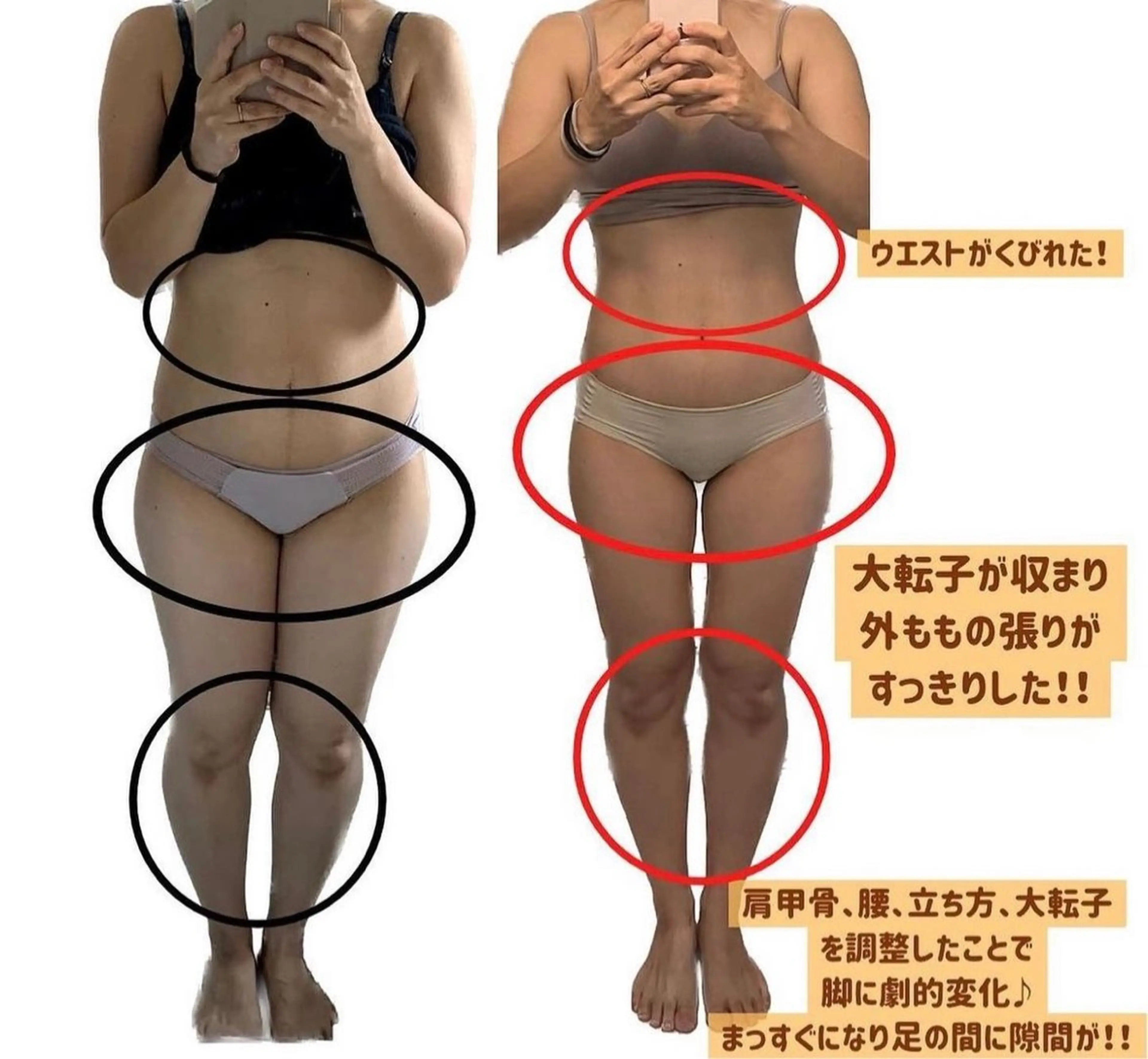 彫刻リンパ/骨盤ケア マヌティーズのその他イメージ