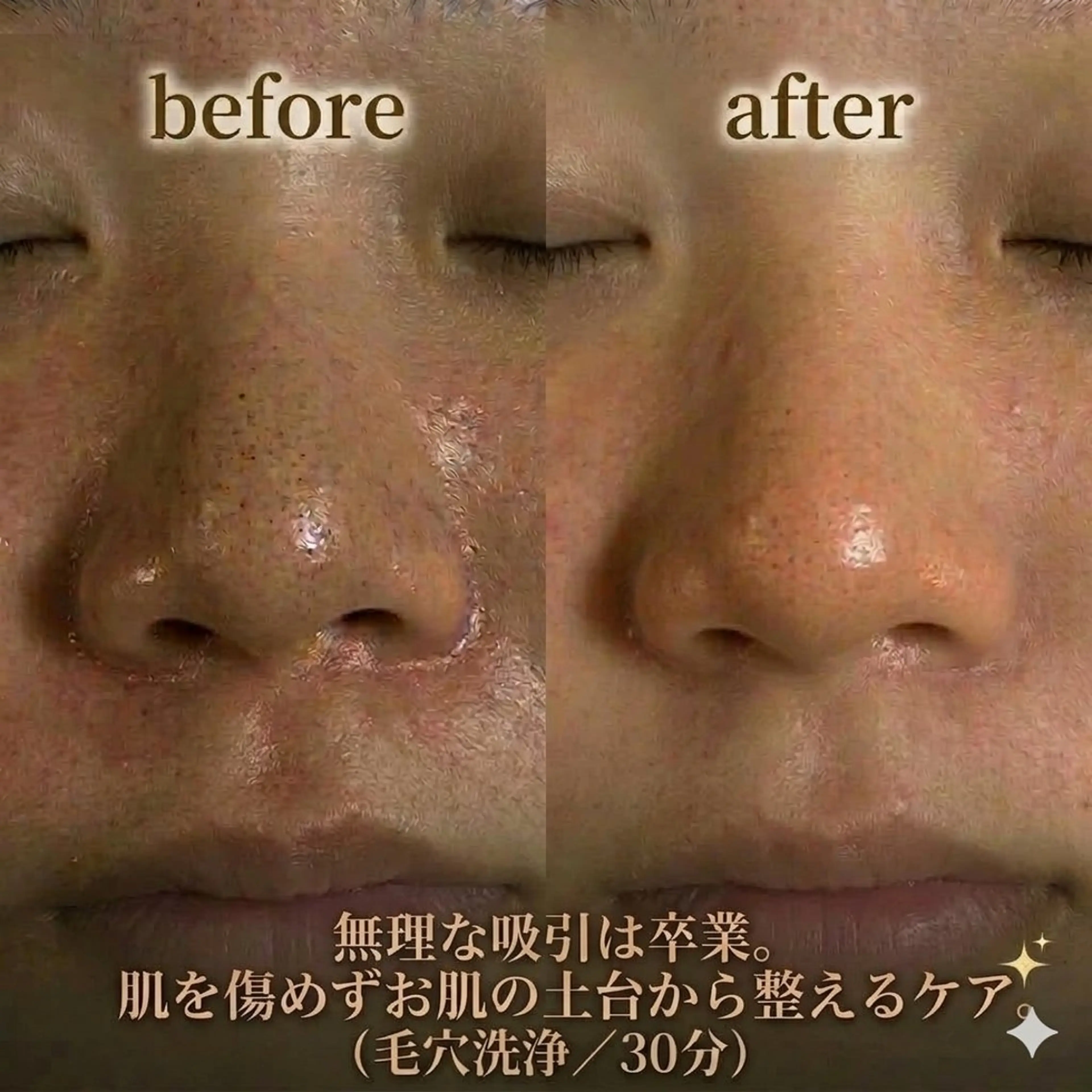 エステ Linomalie エステ/たるみ/脱毛のエステ・リラクイメージ