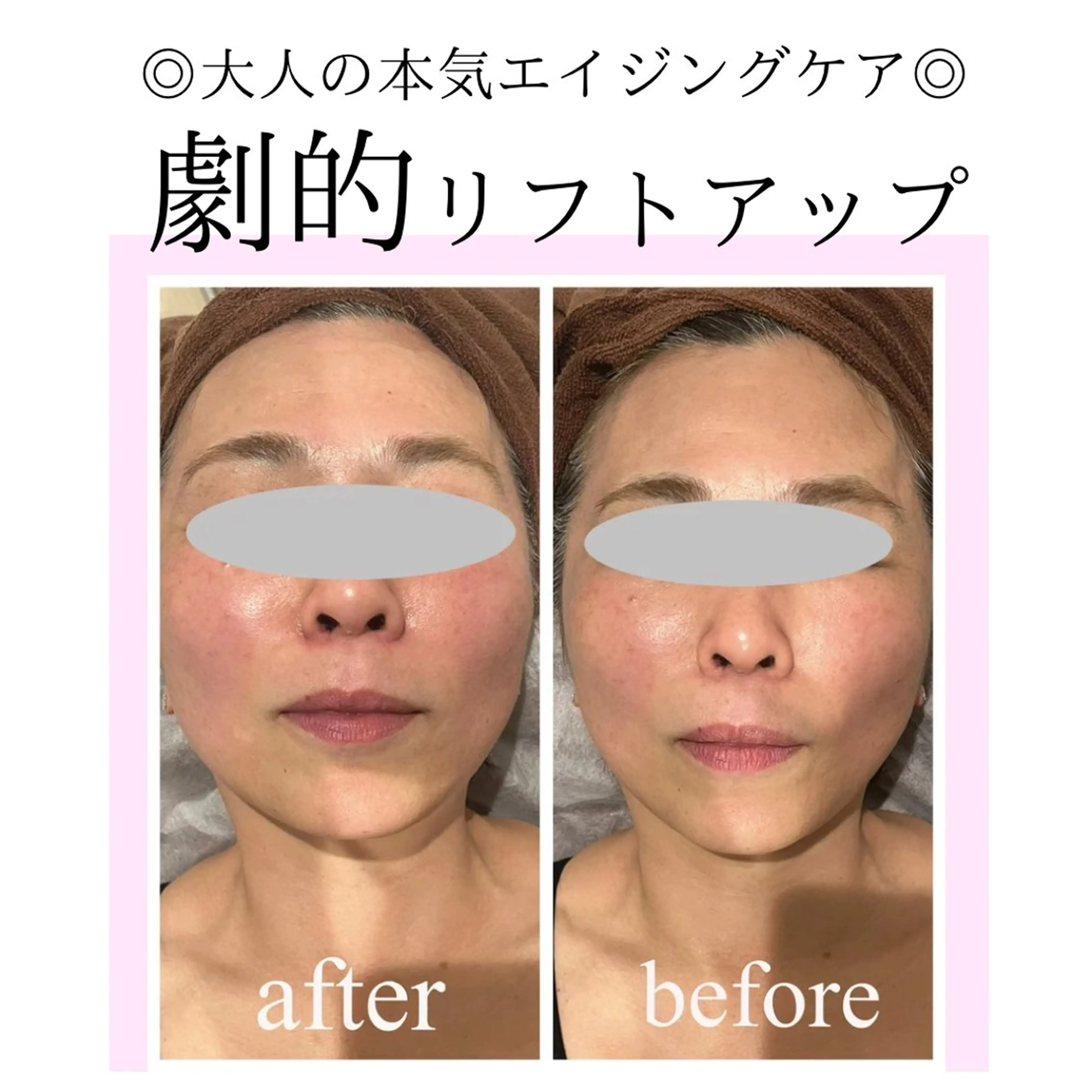 小顔・リフトアップ/ 奈緒美のエステ・リラクイメージ