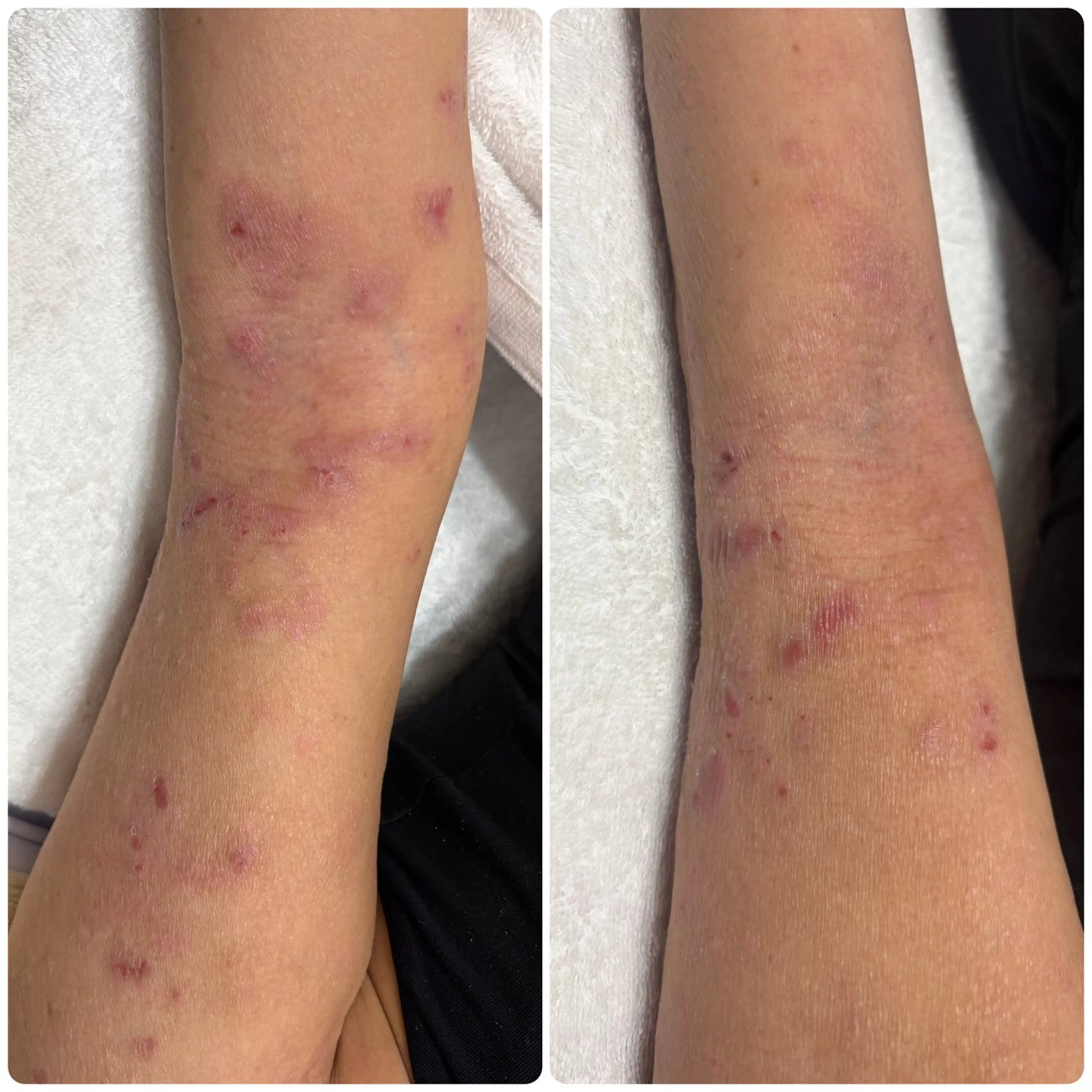 エステ 美と健康サロン Lino leaのエステ・リラクイメージ