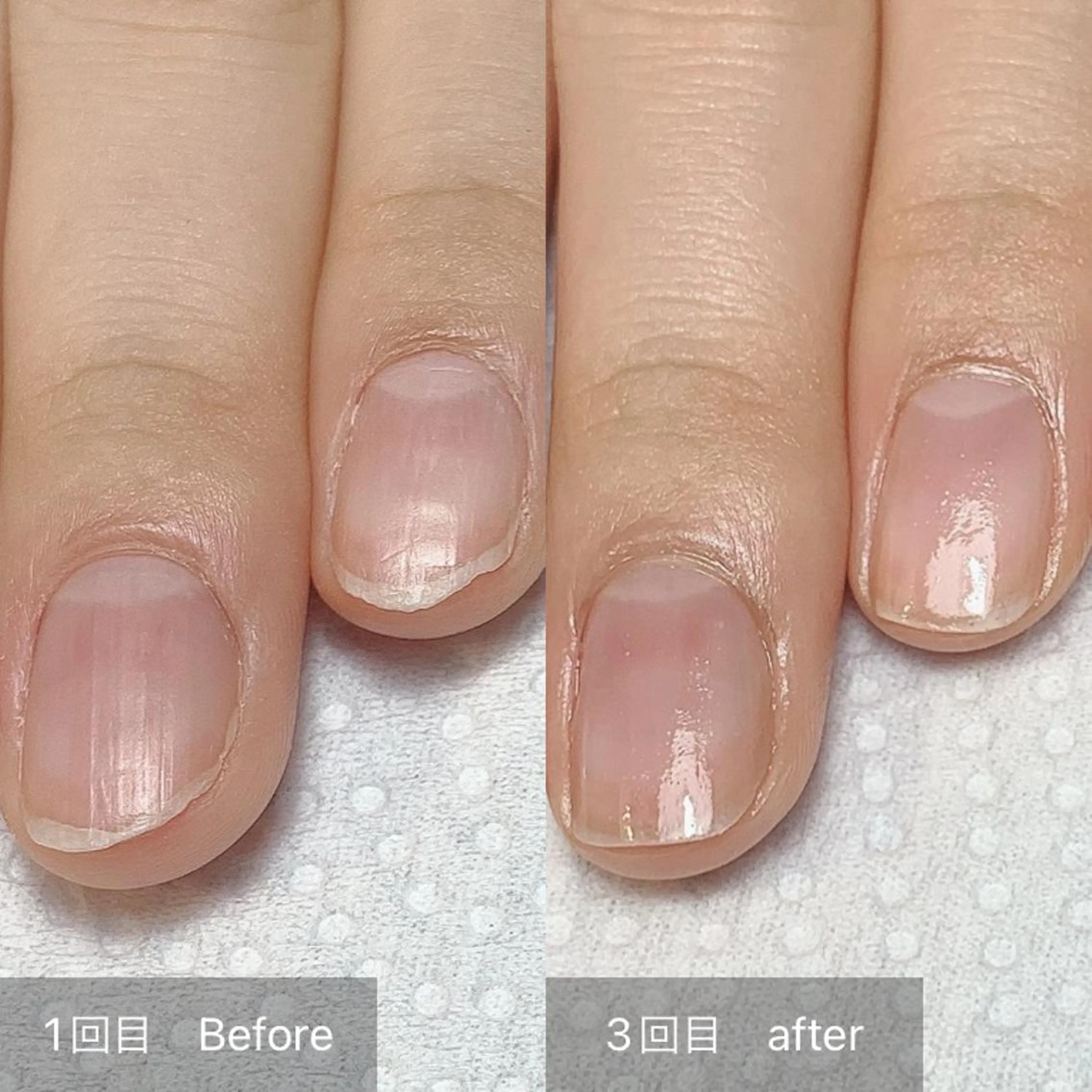 ネイル その他(ネイル) 木村 千晴のネイルデザイン