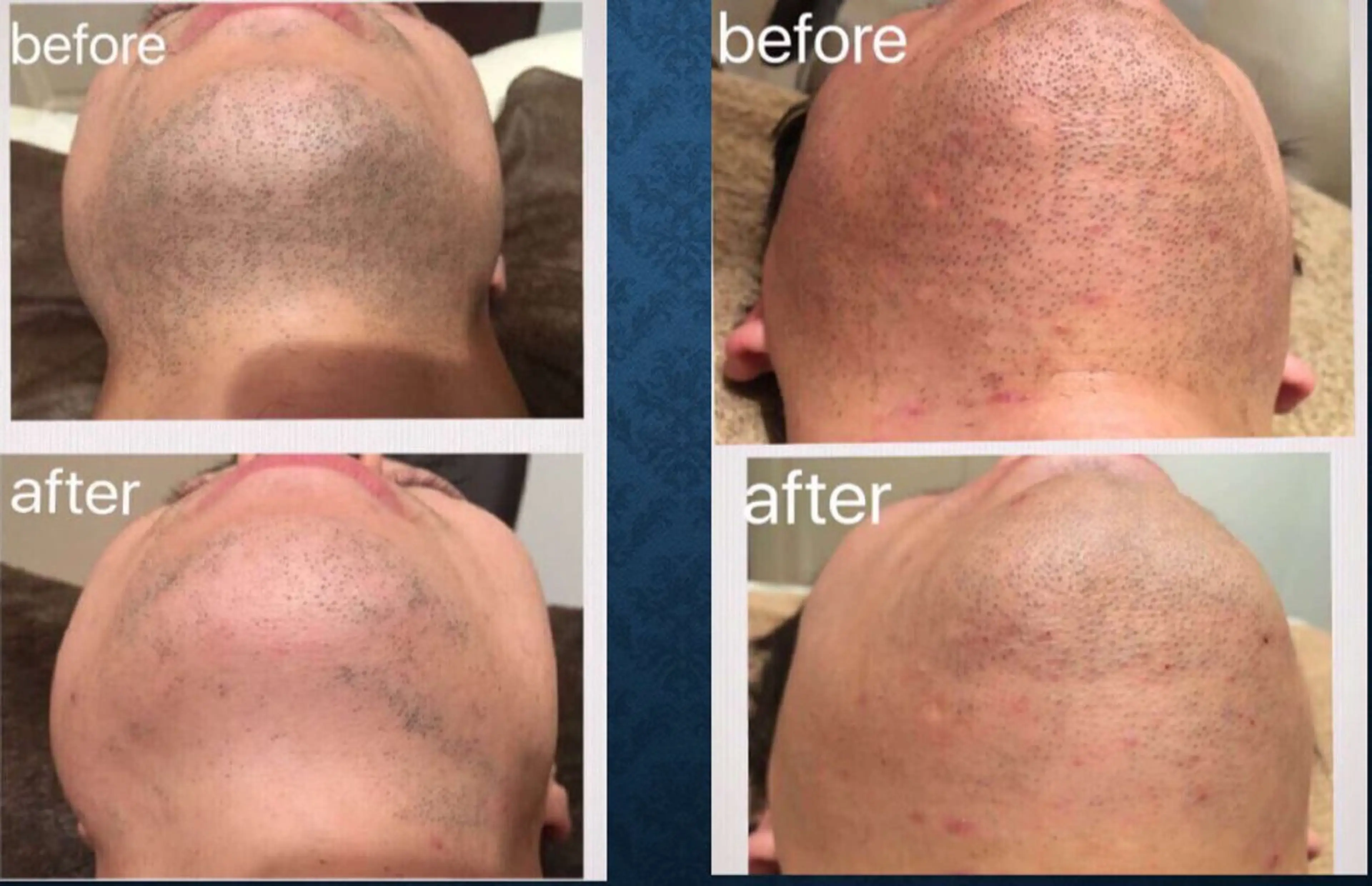 メンズ 稲木 俊子のエステ・リラクイメージ