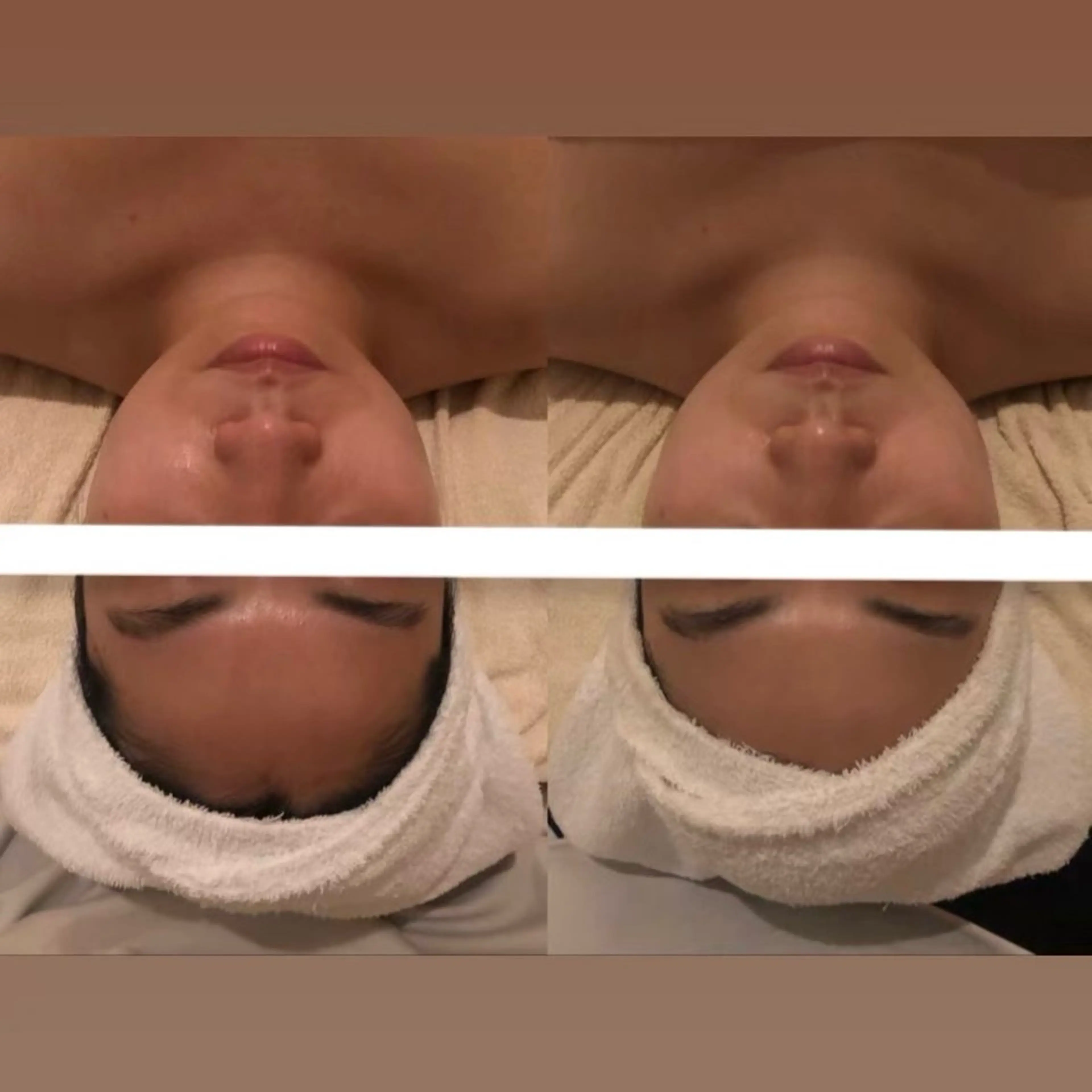 【透明感×小顔】ミニモ限定特別メニュー‼️全身トータルケアエステ💆🏻♀️🫧 乾燥はもちろん、むくみもすっきり✨の写真