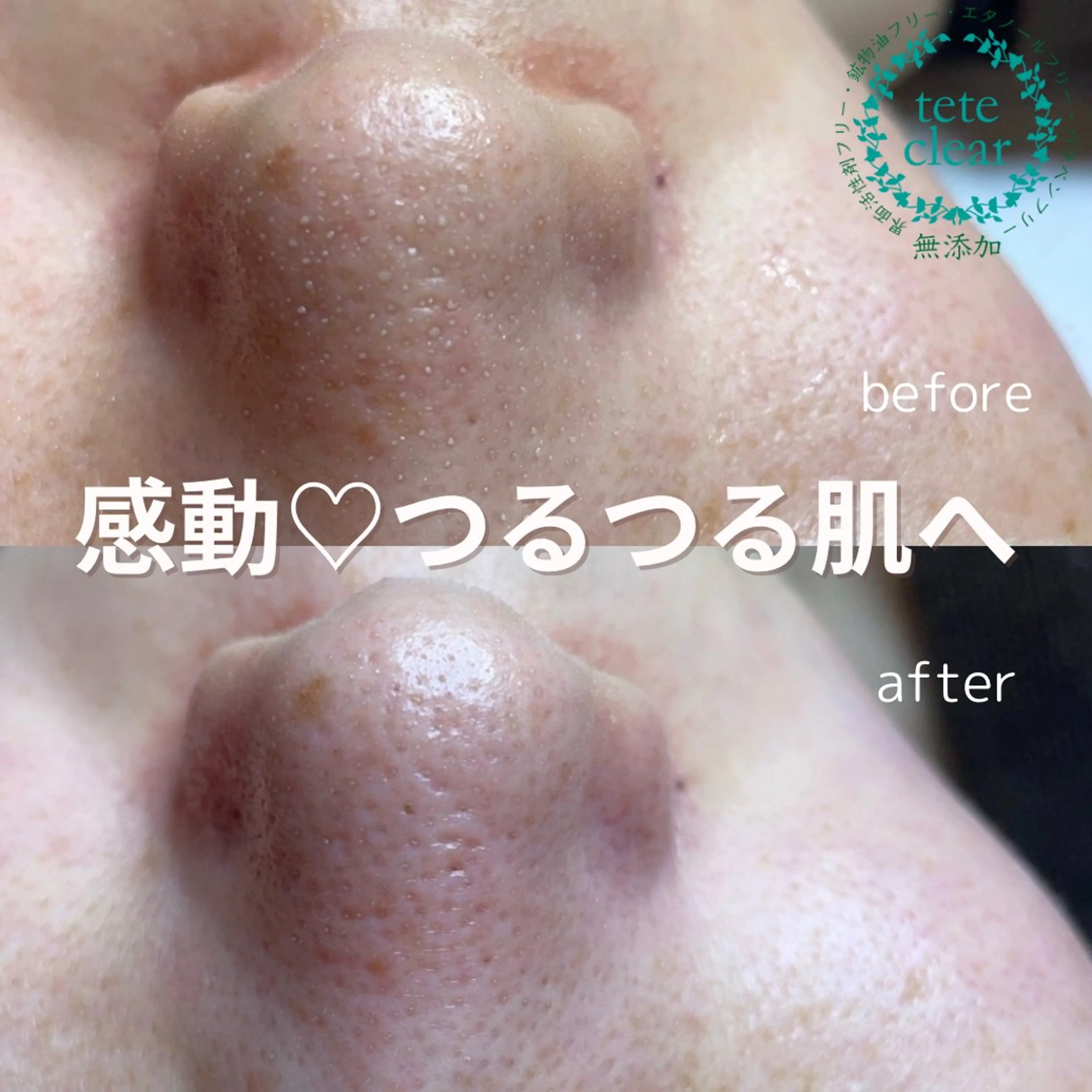 and R 男女 脱毛、毛穴サロンのエステ・リラクイメージ