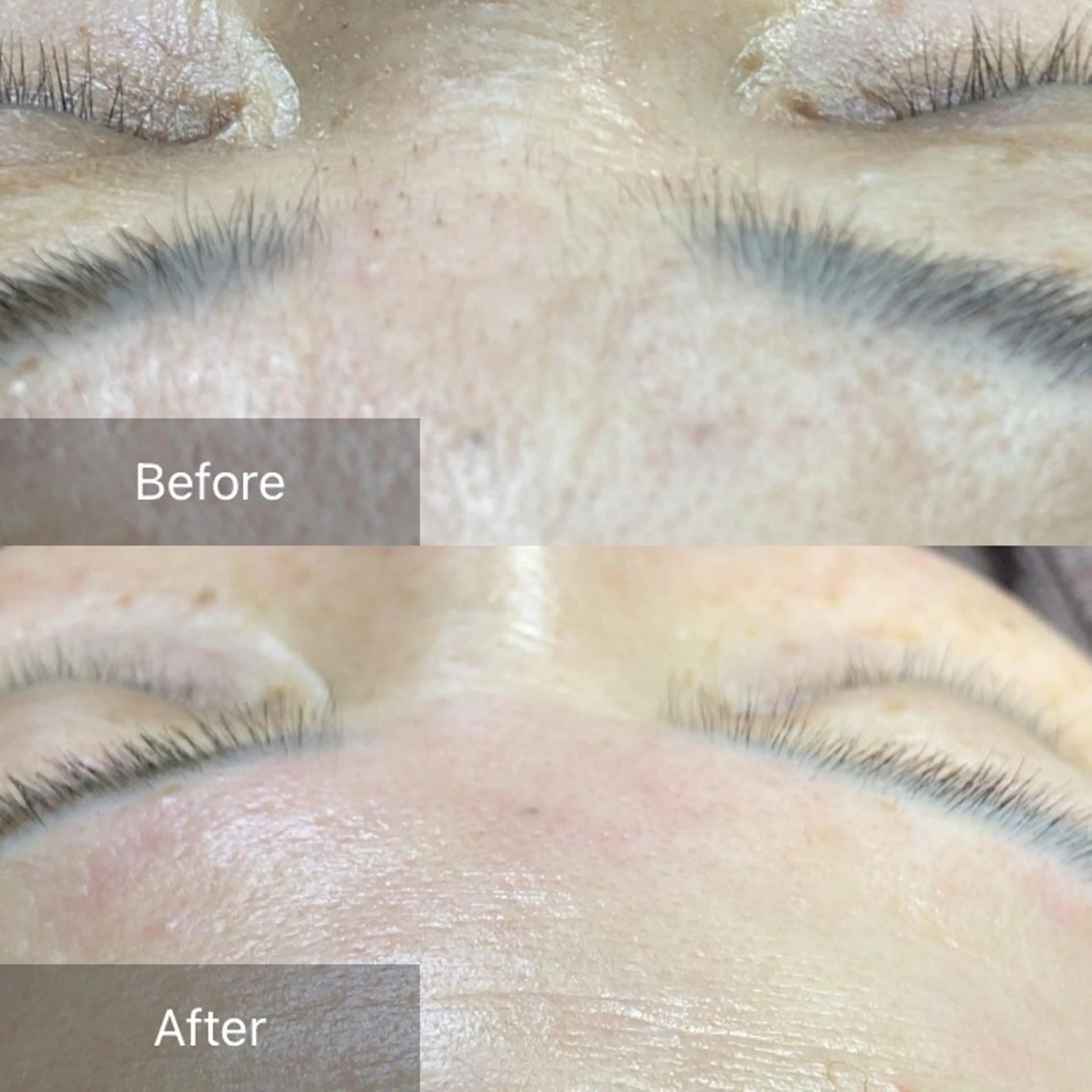 脱毛 産毛専門店 Bittoのエステ・リラクイメージ