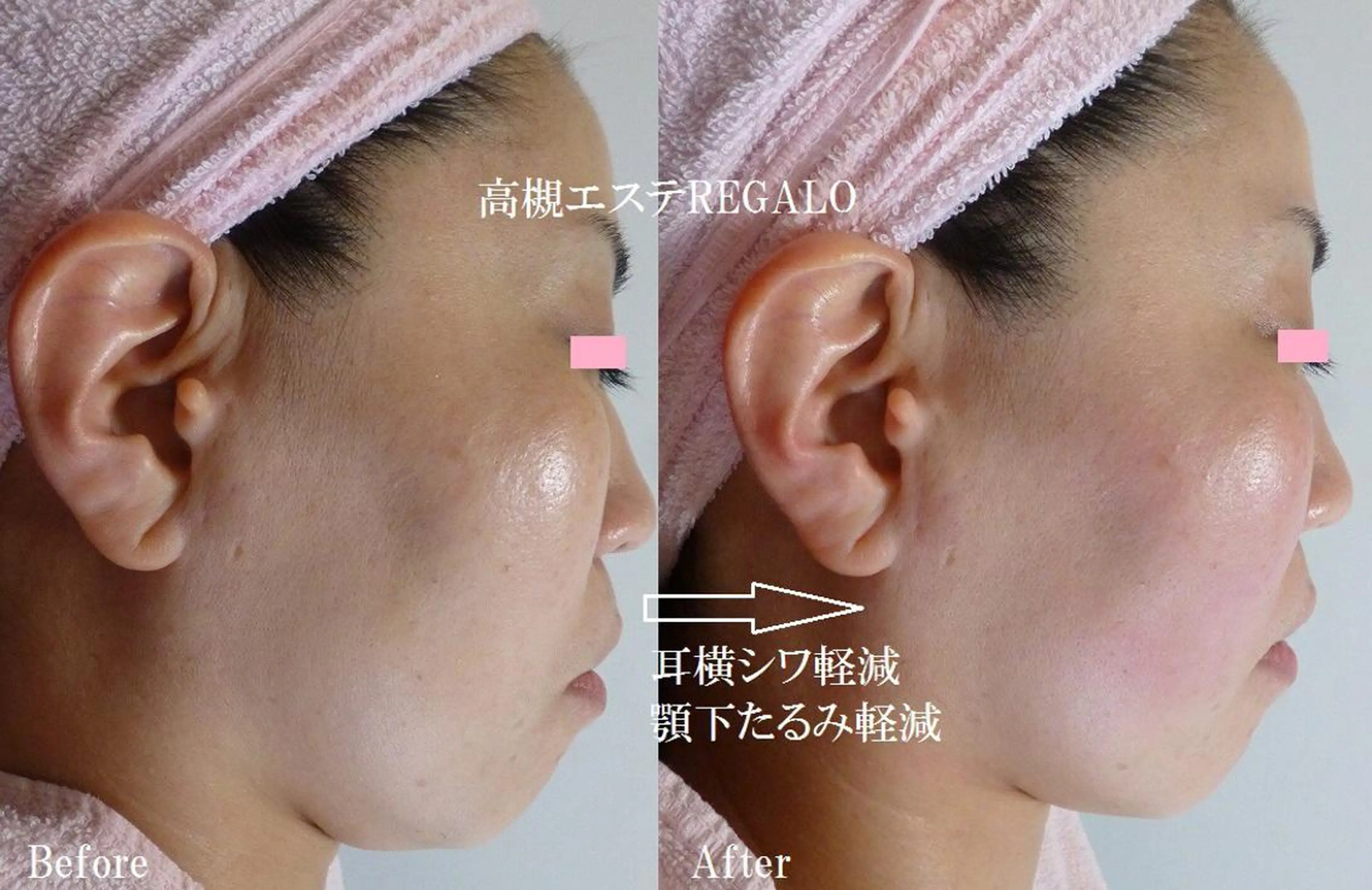 エステ 矢野 さやかのエステ・リラクイメージ