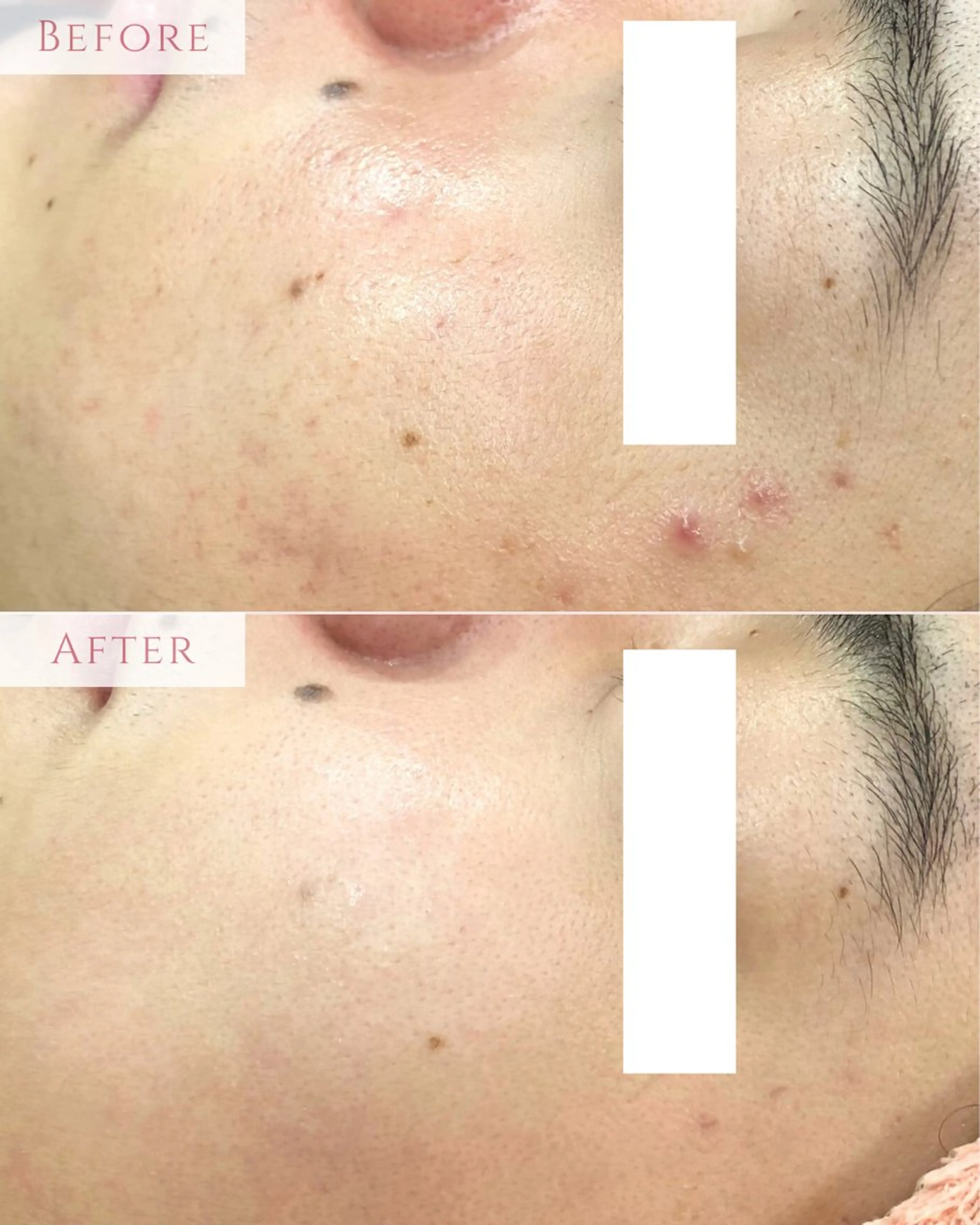 エステ 肌質改善専門サロン Bellmi/心斎橋のエステ・リラクイメージ