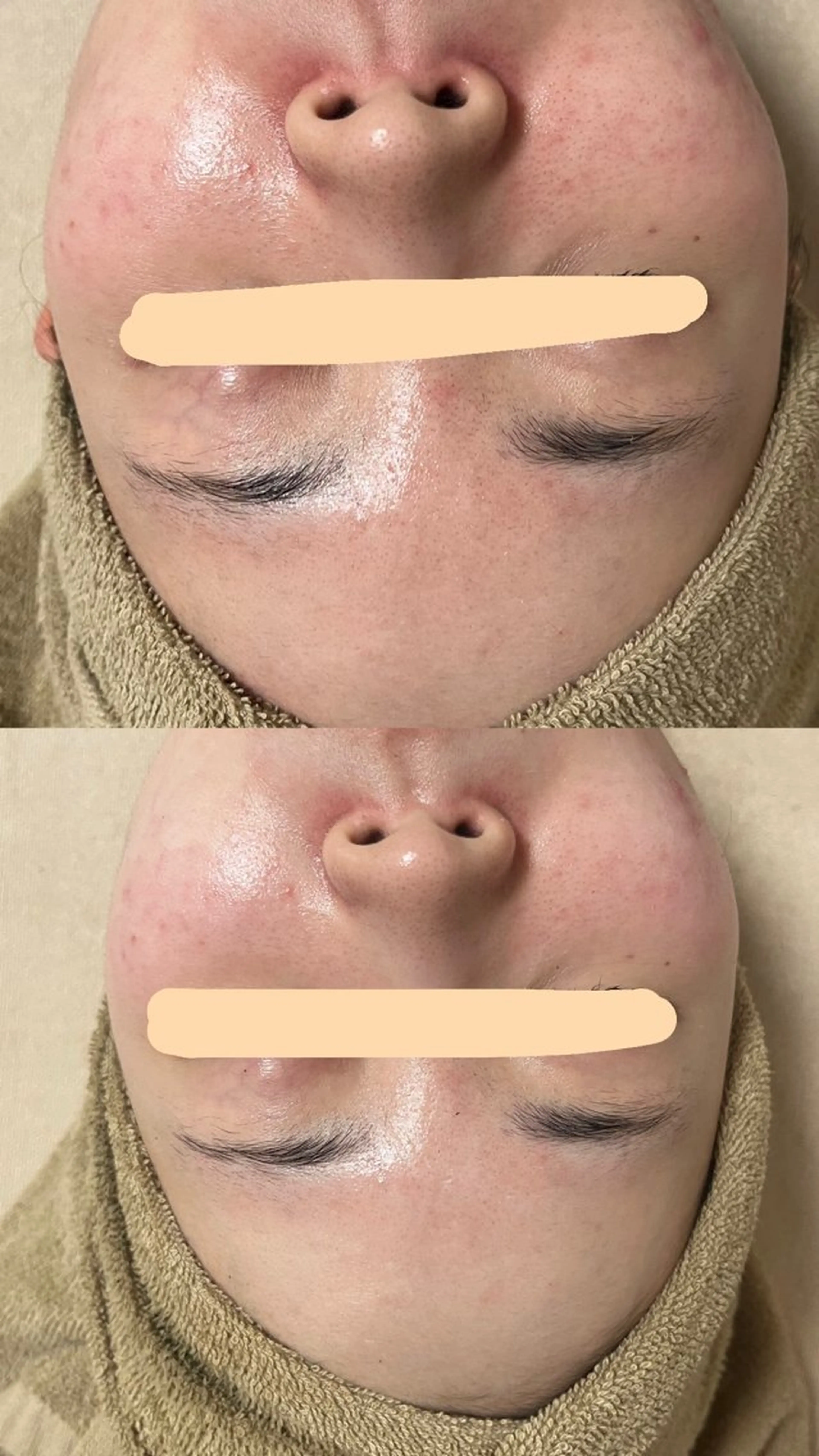 エステ 出口 玲菜のその他イメージ