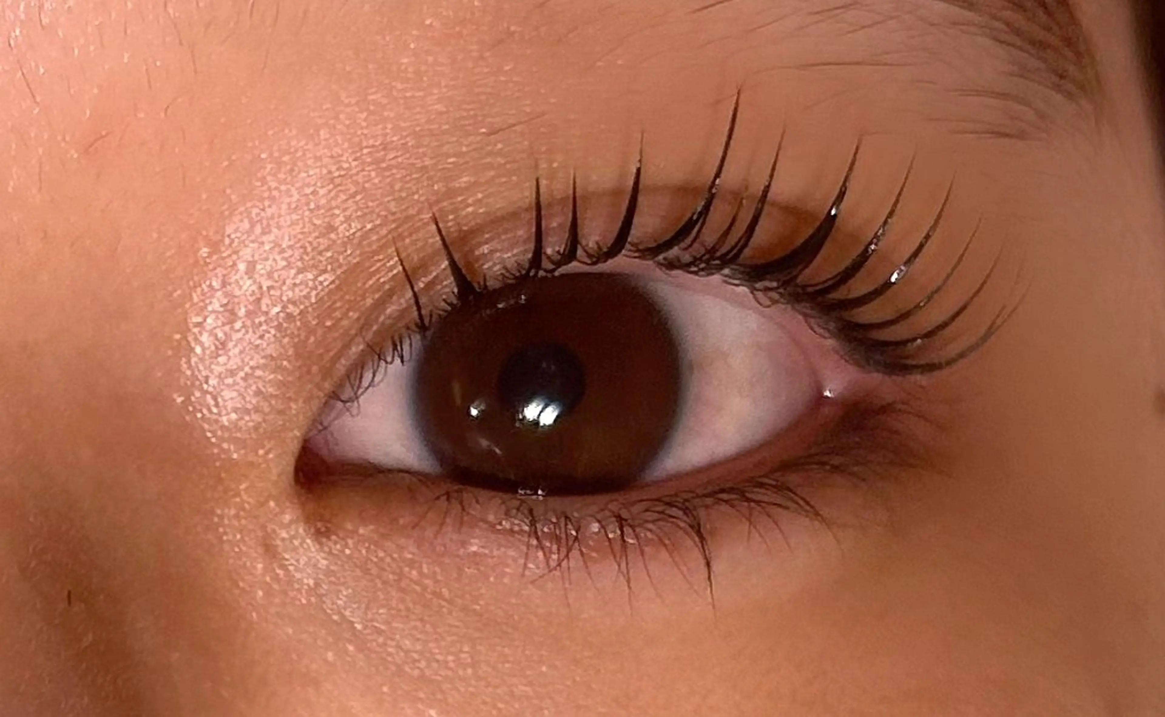 セラムラッシュリフト(上のみ)の写真