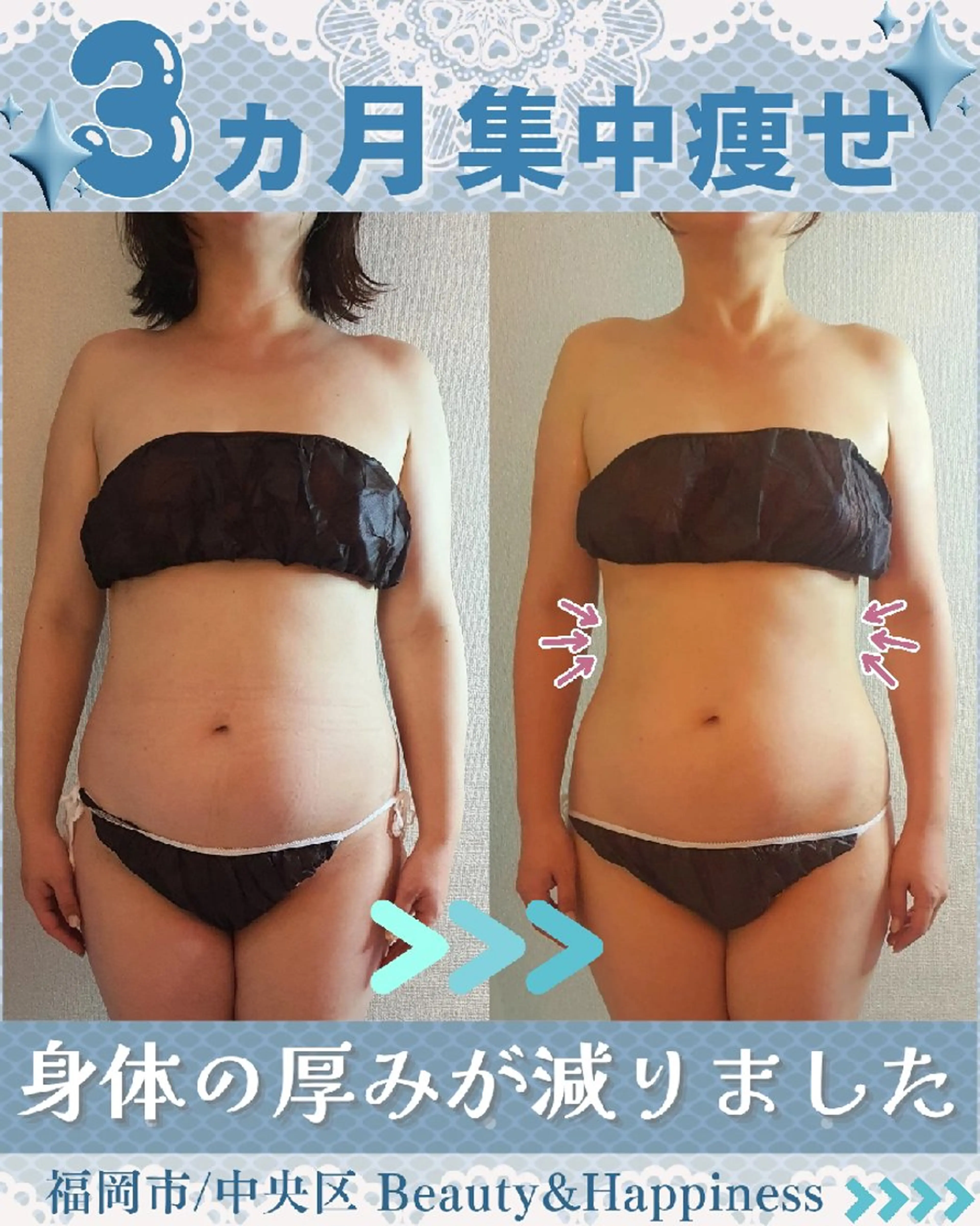 エステ リラク 痩身ハーブピーリング 筋膜リリース☆B&Hのエステ・リラクイメージ