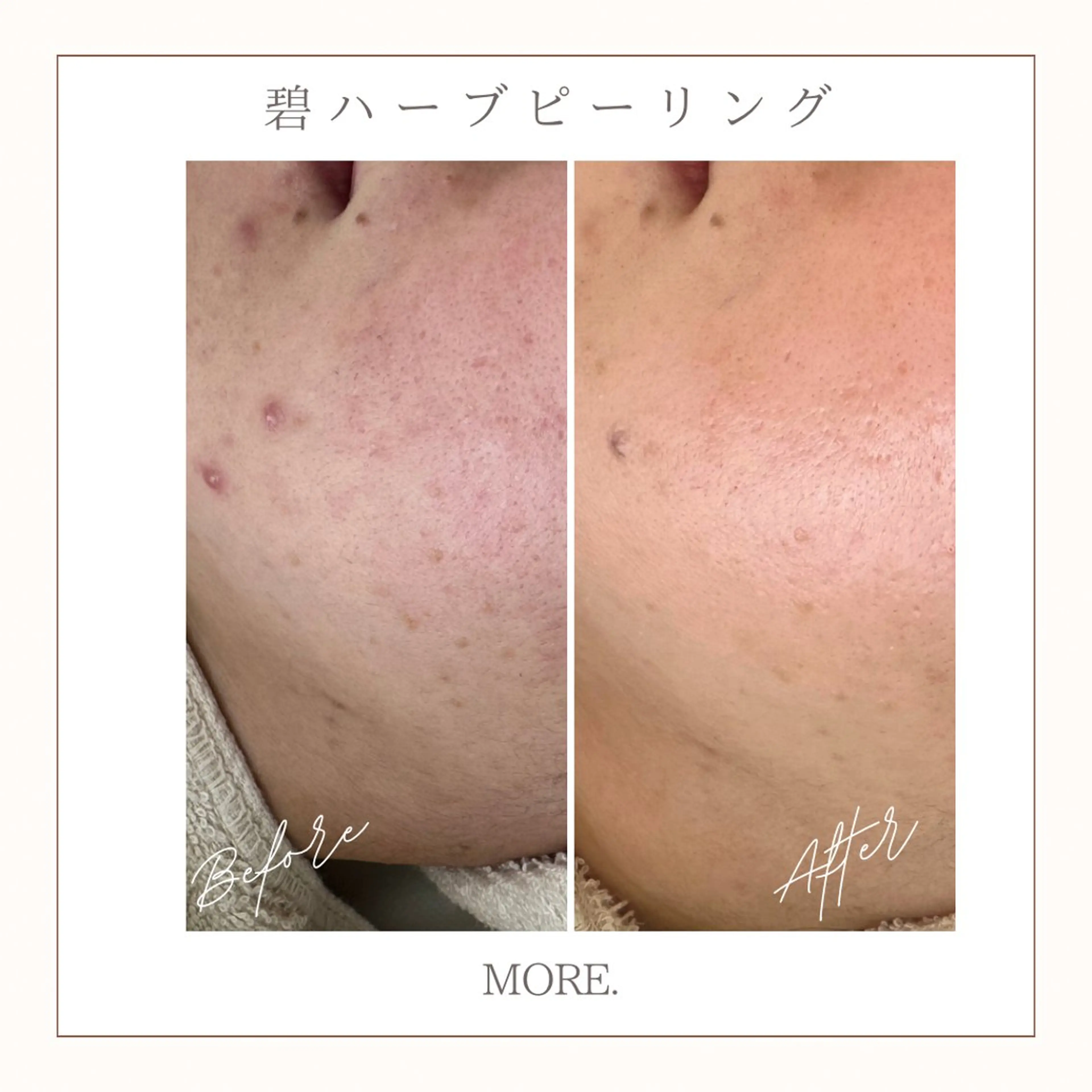 MORE. NEMAのエステ・リラクイメージ