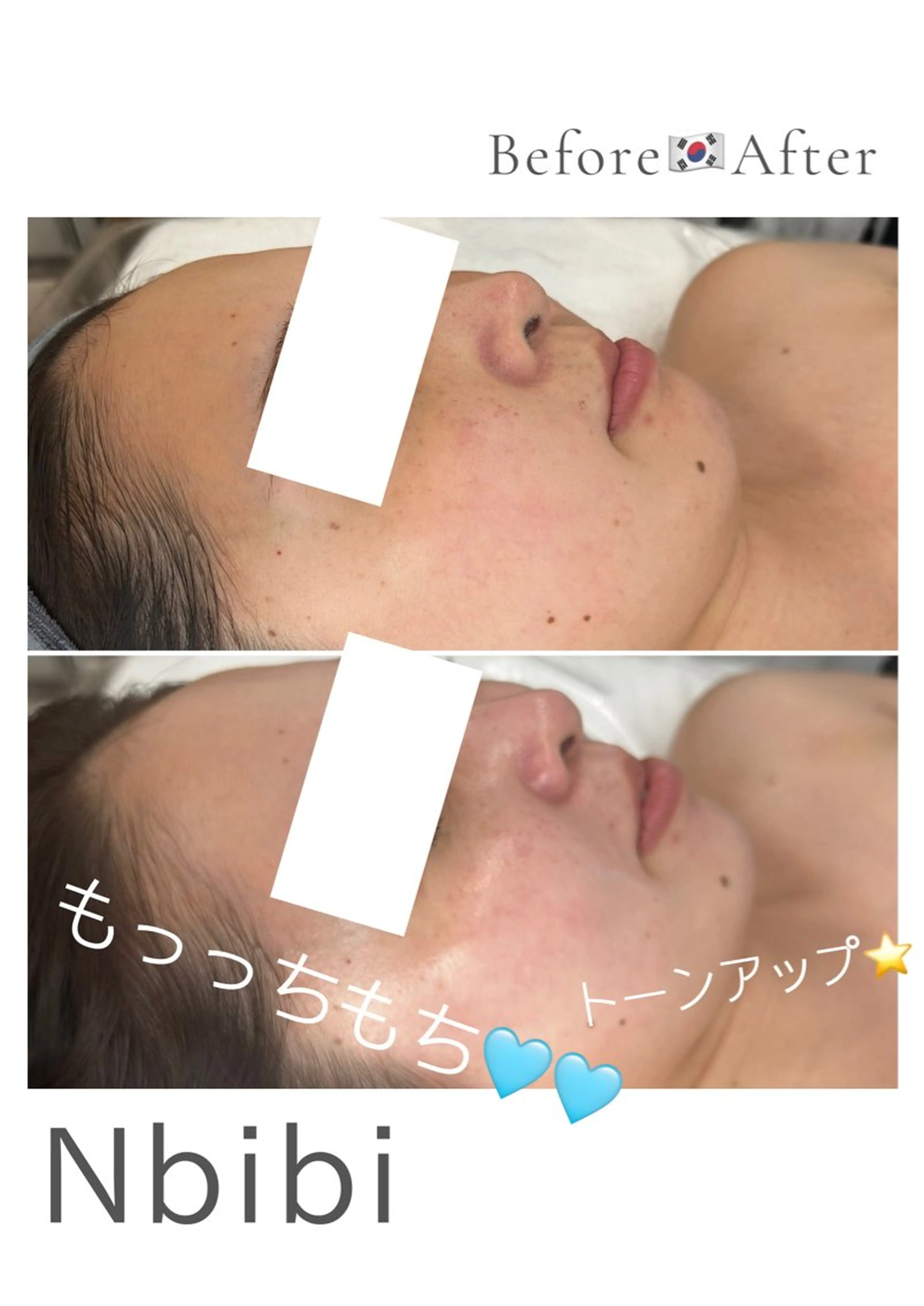 エステ 韓国🇰🇷価格 サロン_Nbibiの眉毛・アイブロウイメージ