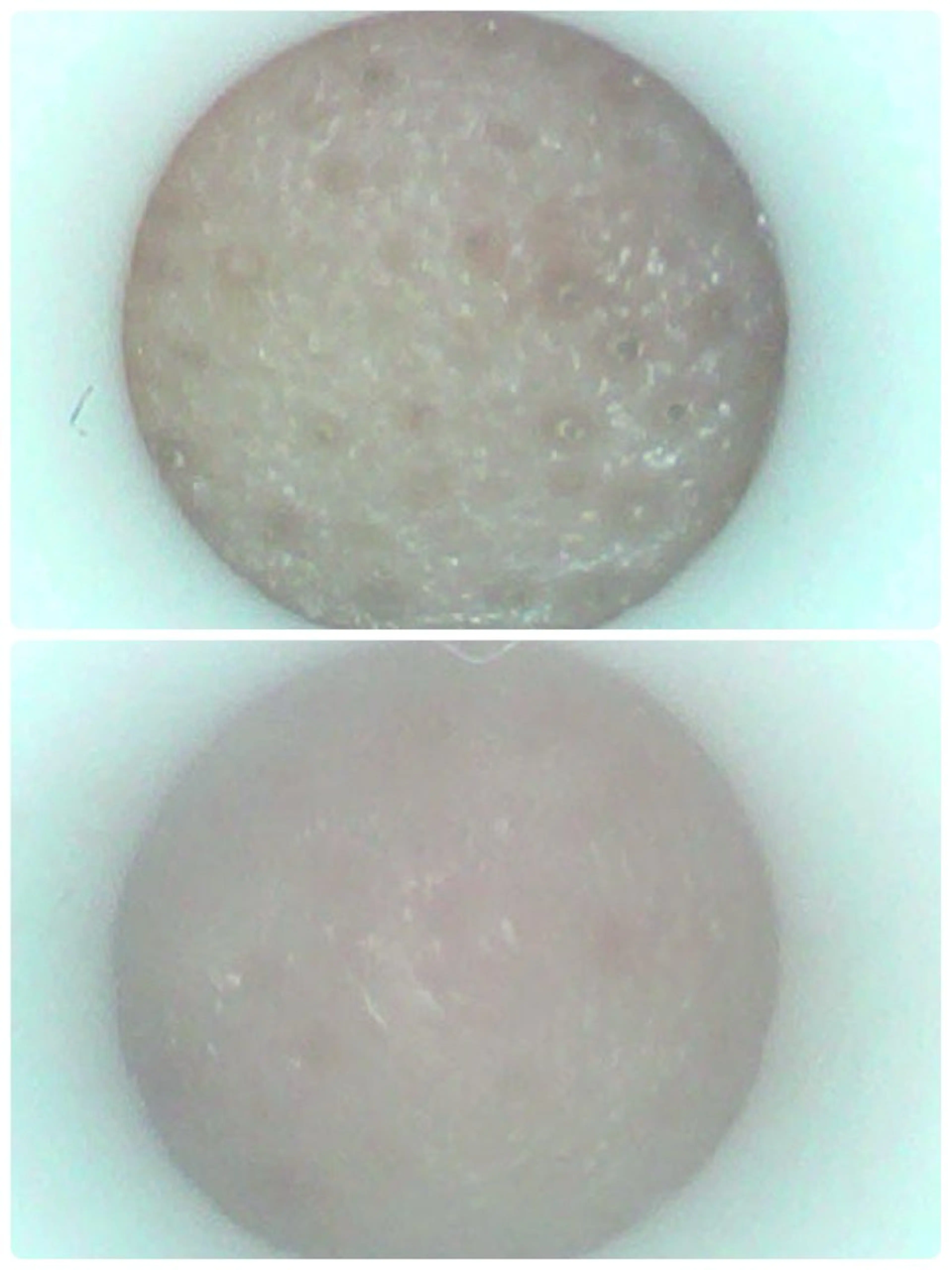 【黒ずみ悩みの方必見】毛穴吸引～デコルテ・首・ヘッドのほぐし付き60分+カウンセリング10分の写真