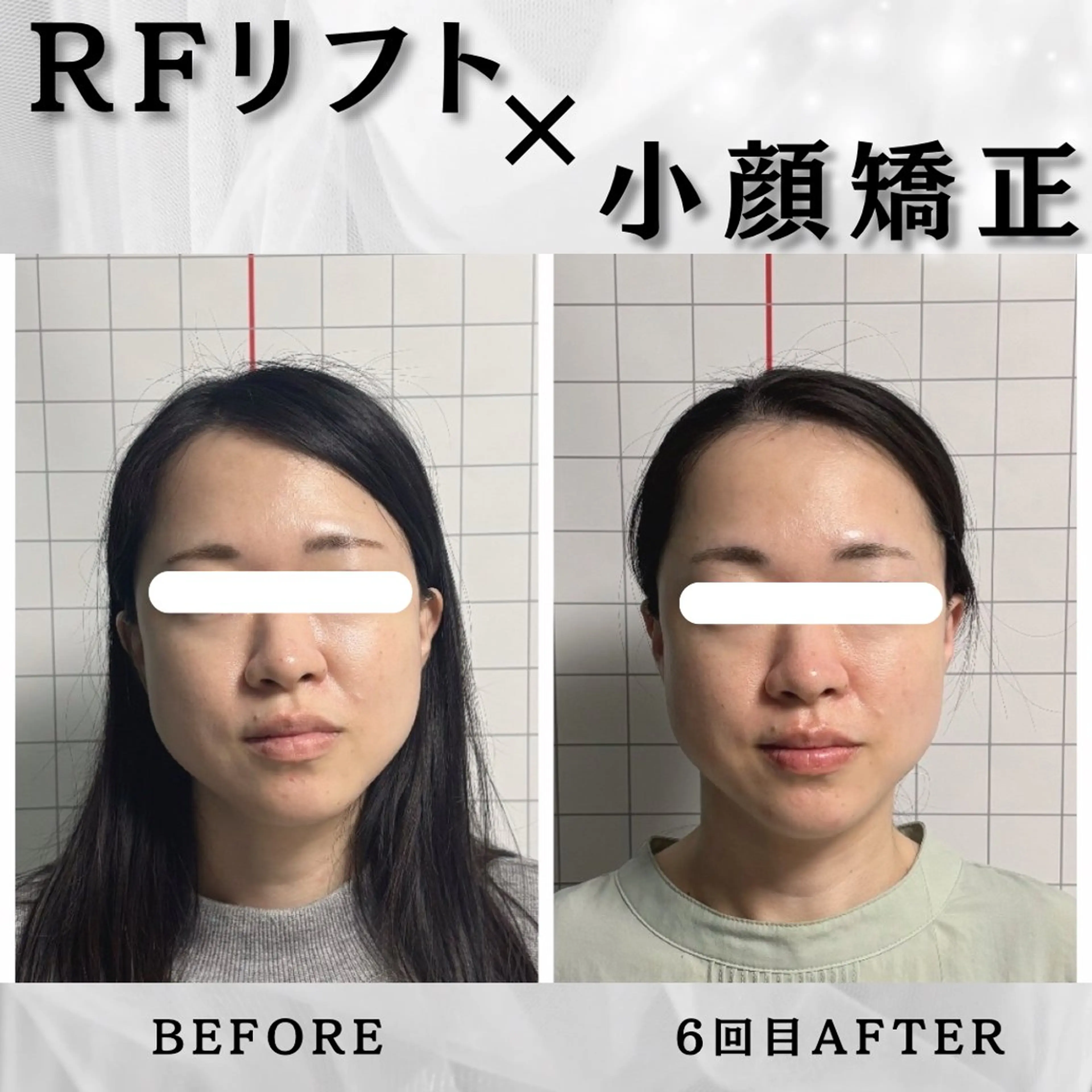 エステ リラク 小顔矯正専門店 【RED】池田のエステ・リラクイメージ