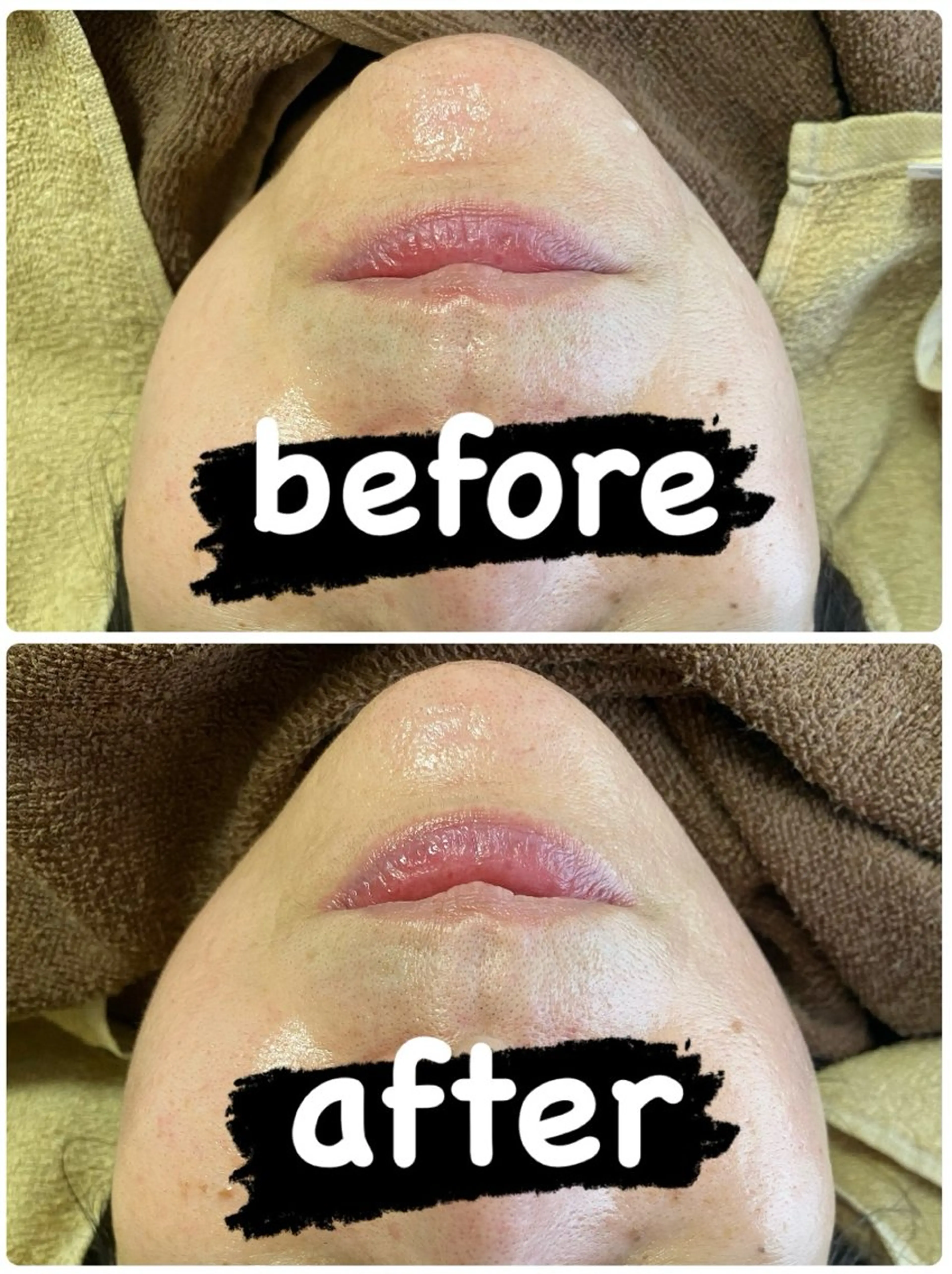 冷えむくみ改善専門 REBISKIN🌿のエステ・リラクイメージ