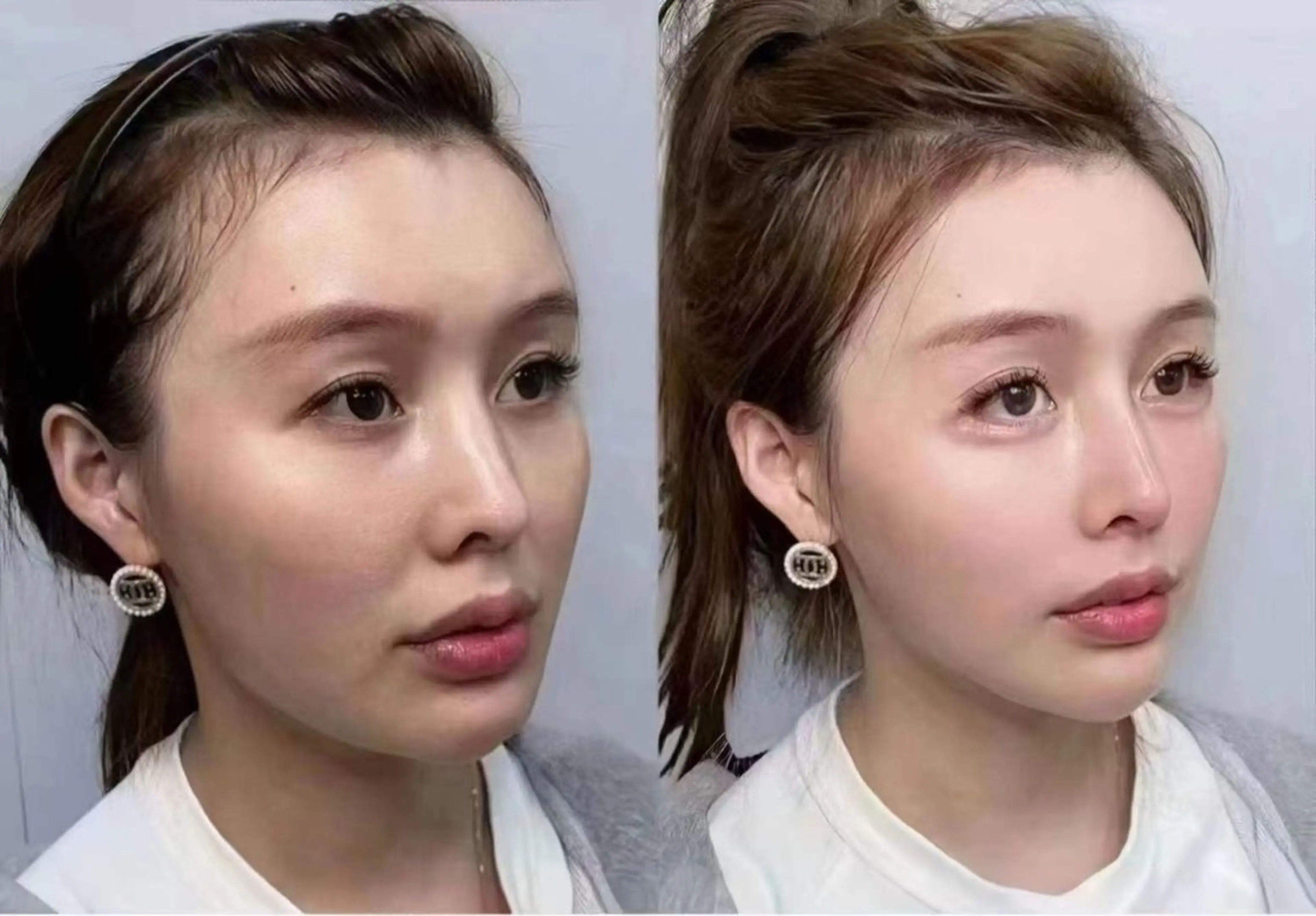 ネイル ブライダルネイル ホワイト エステ aliaハイフ&水光ジェットサロン所属・aliaハーブ水光店 エステティシャン募集のエステ・リラクイメージ