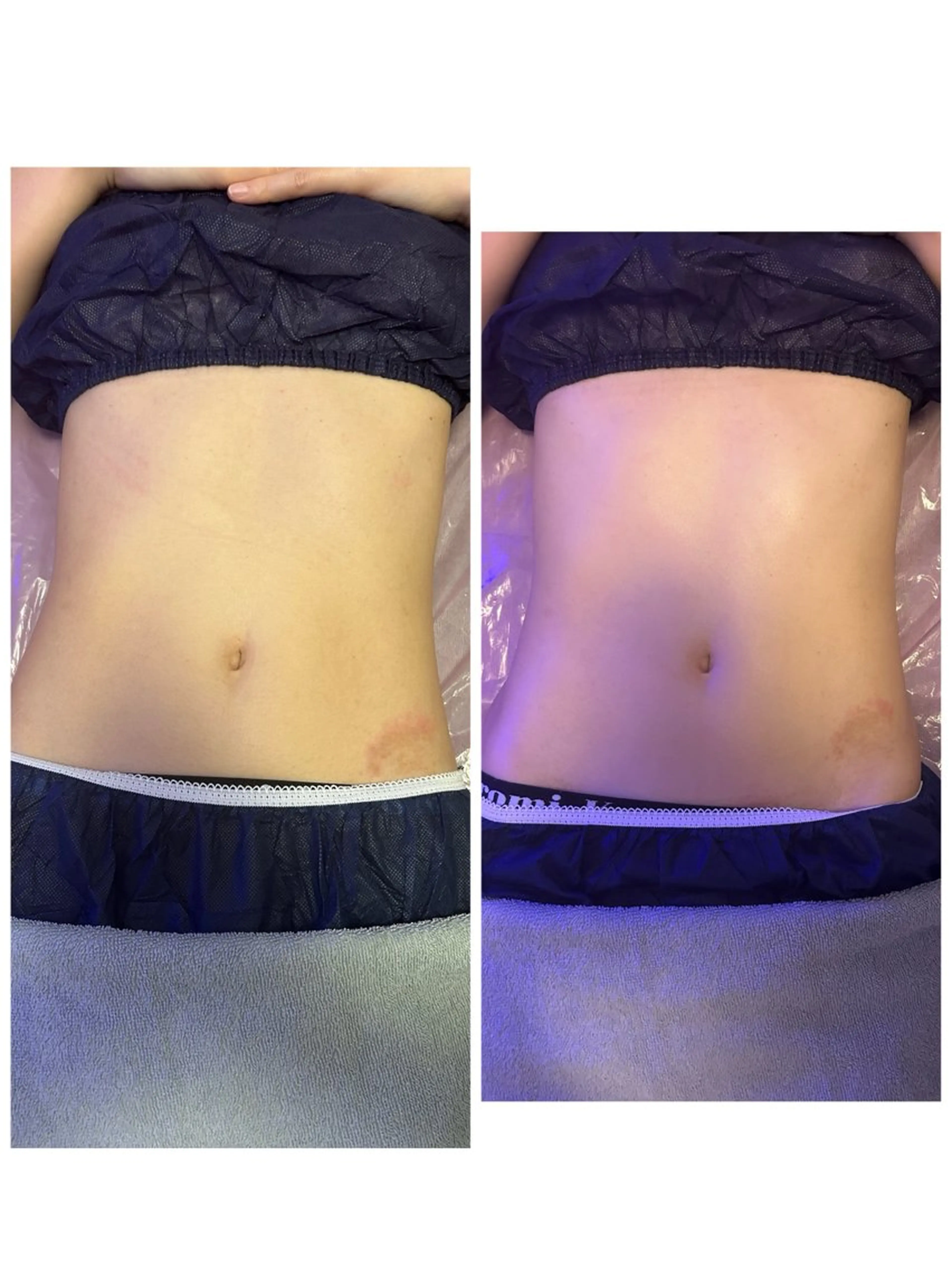 その他 esthesalon Ran所属・小顔美肌痩身サロン Ranのその他イメージ