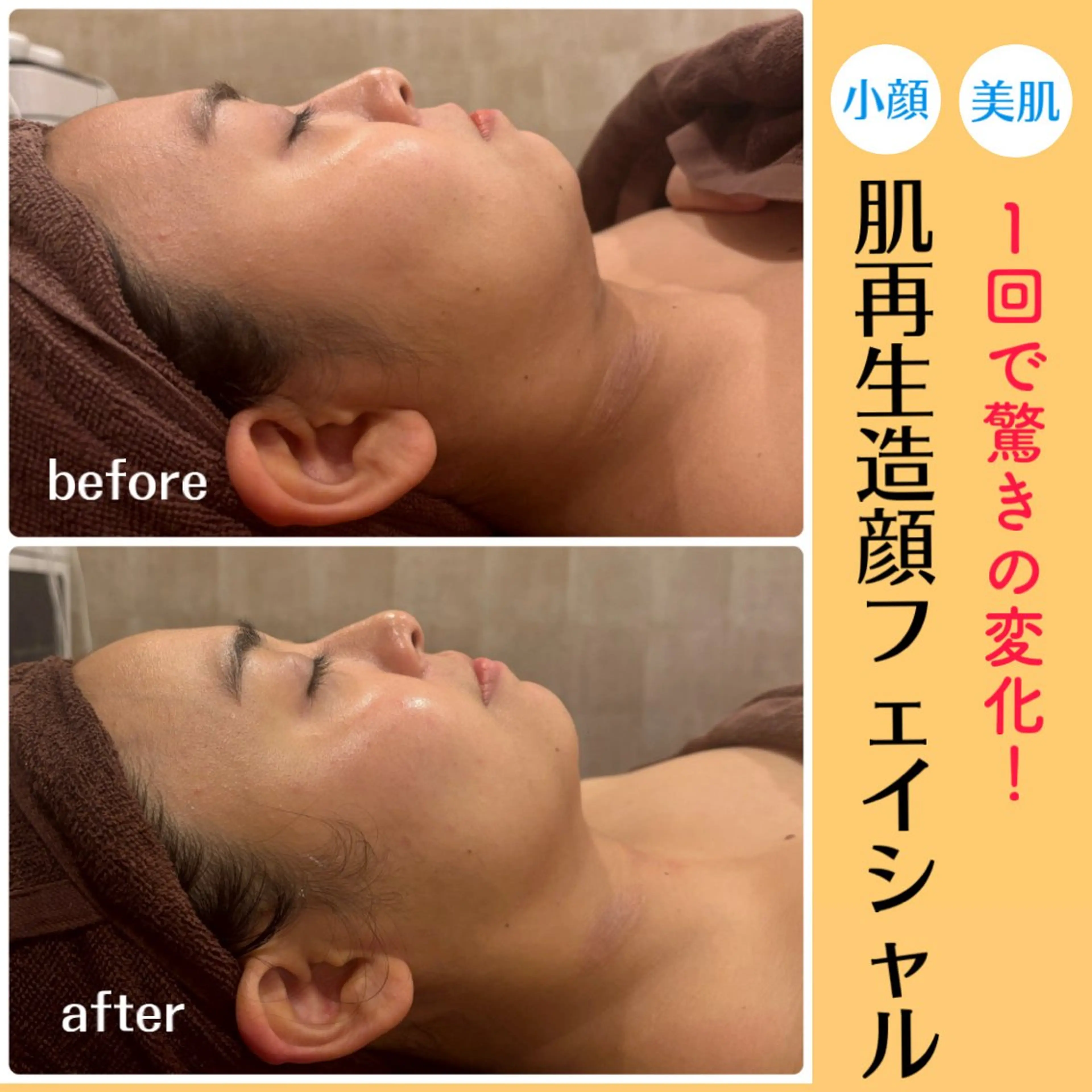 【韓国式肌管理🎀】ララピール超え✨️徹底リフトアップ➕お肌の土台から肌細胞を整えお肌の育成💖美肌と小顔が一度に️🫧の写真