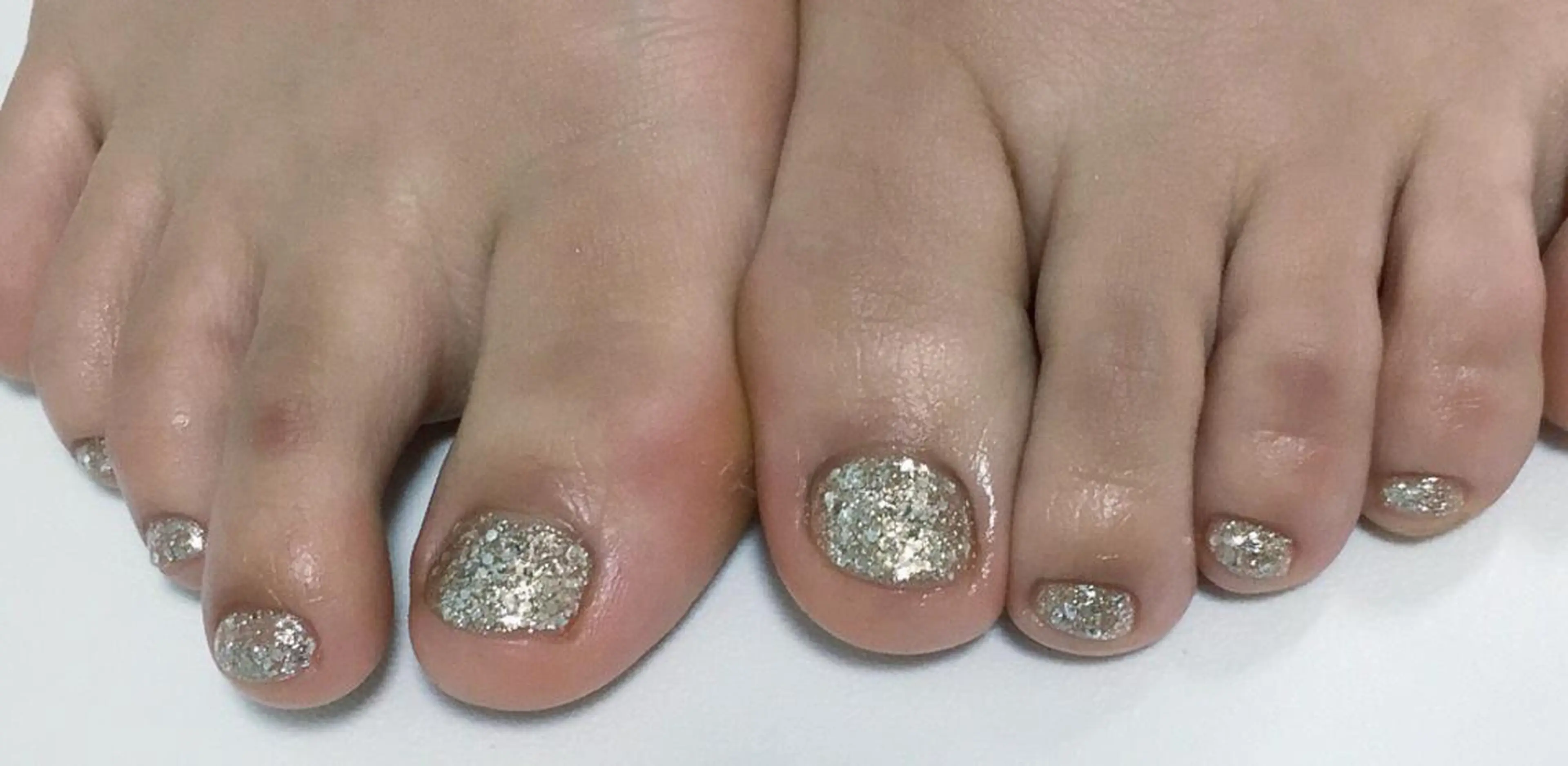 ネイル フィルイン／自爪育成 ／爪に優しい施術のネイルデザイン