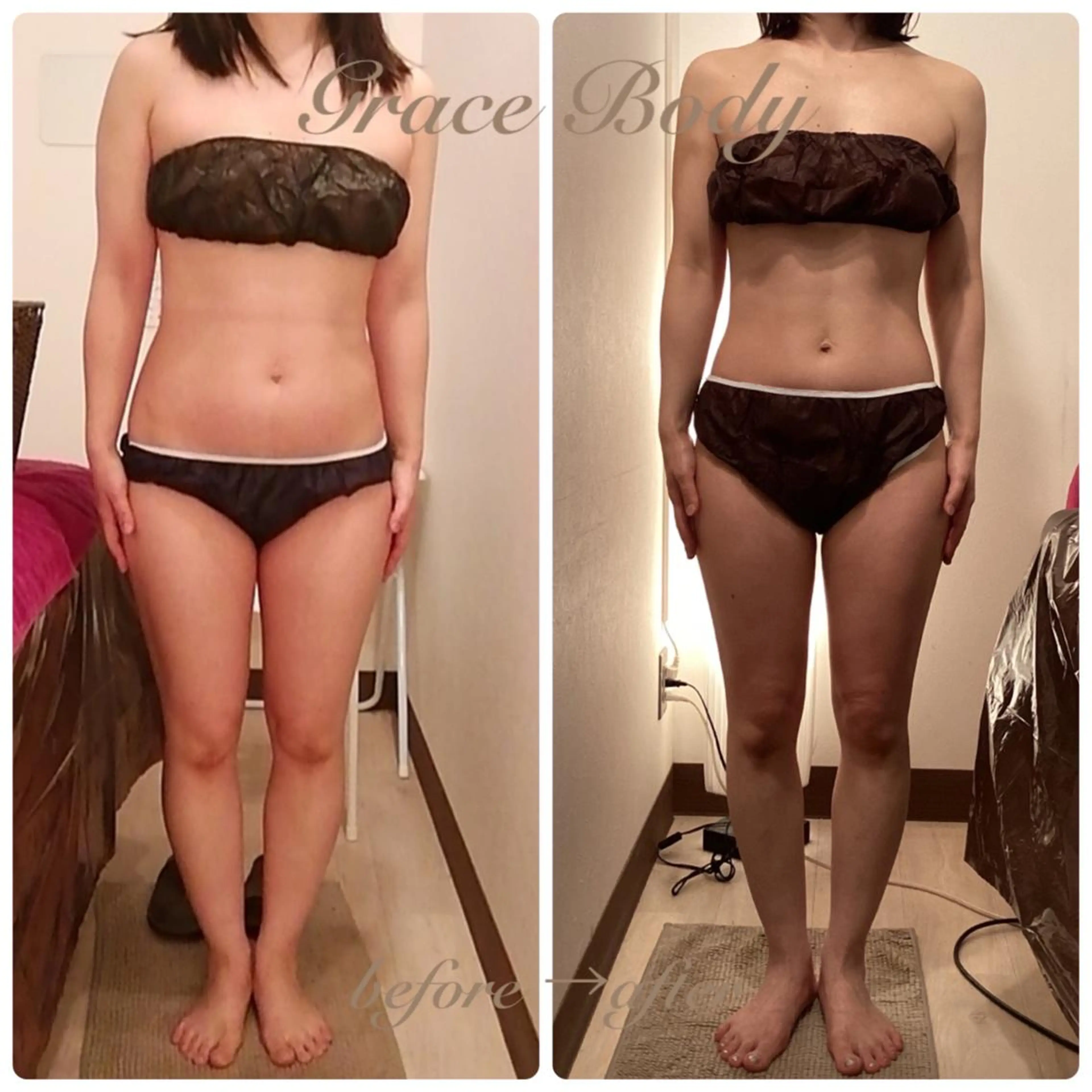 小顔専門店 グレイスボディ三郷店のエステ・リラクイメージ