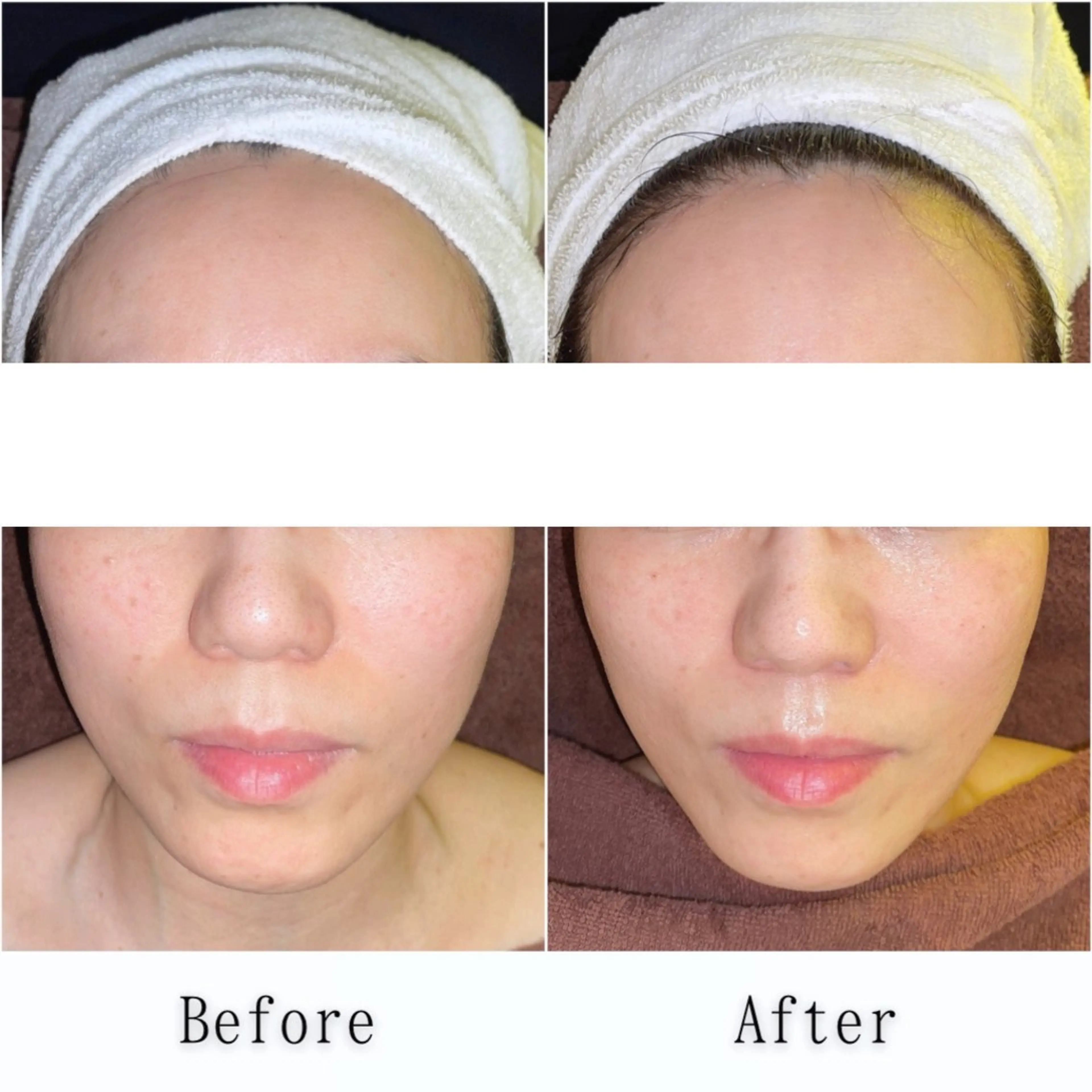 【引き上がる小顔トリートメント】の写真