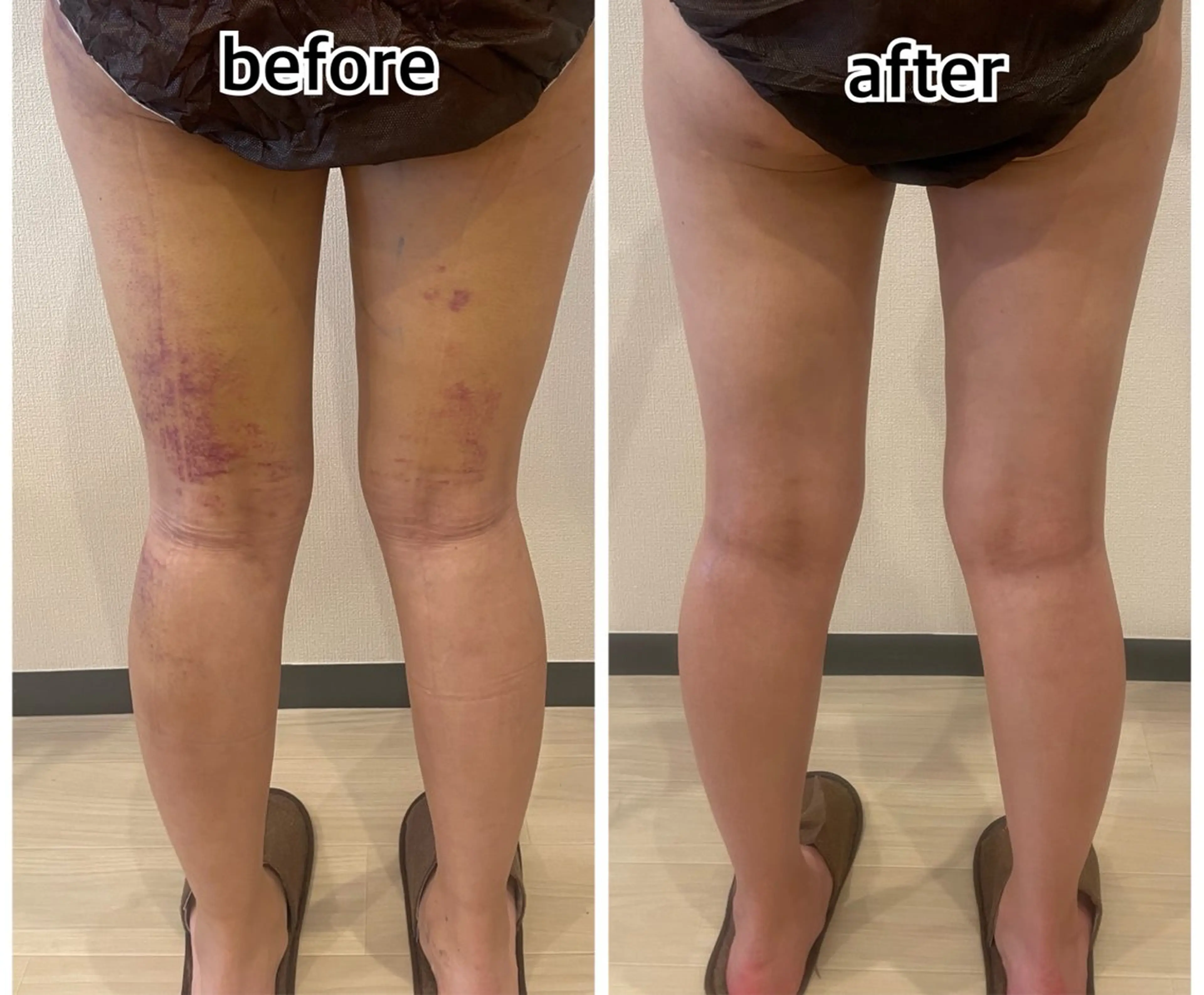 💎 GEM💎のエステ・リラクイメージ