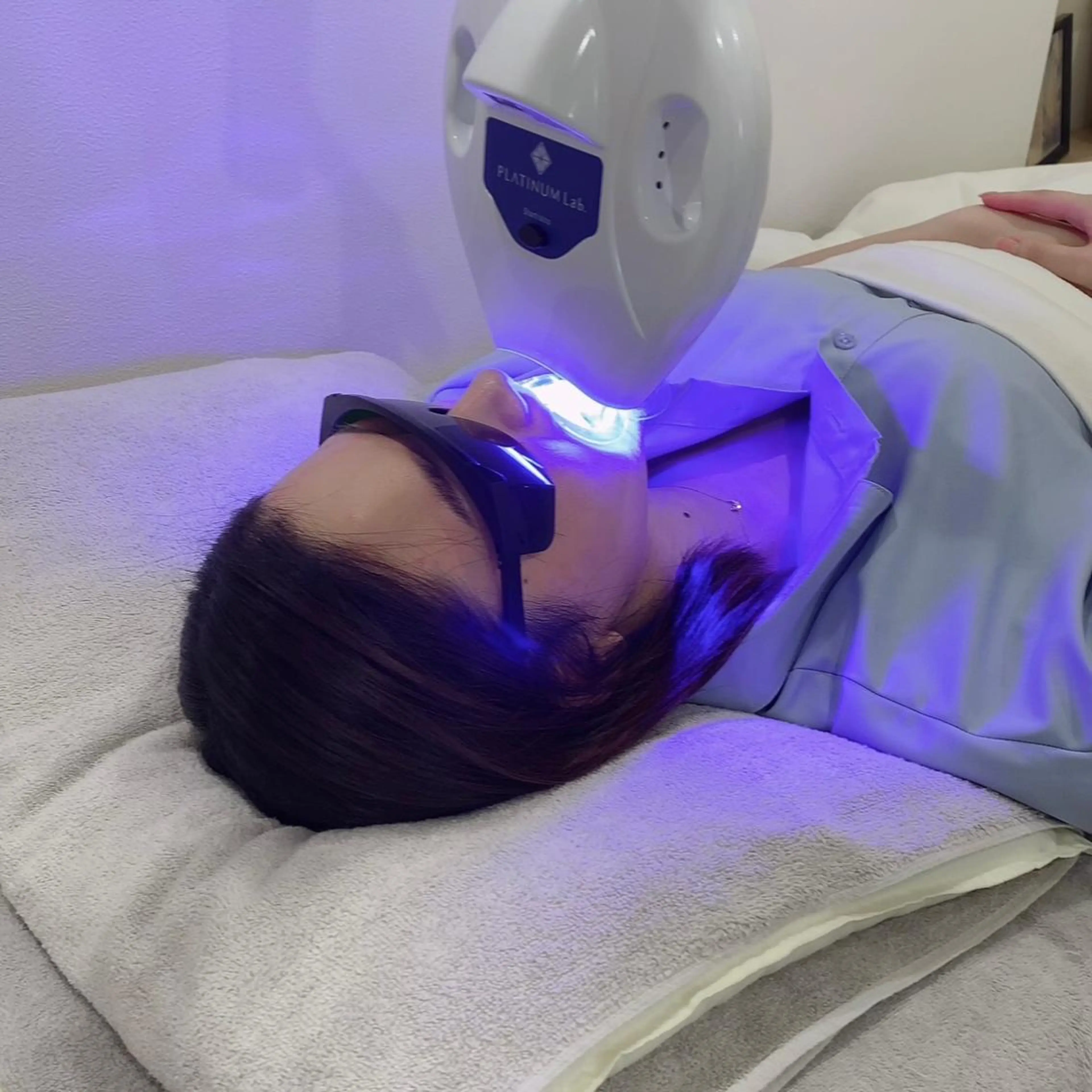 セルフホワイトニング 🦷口元垢抜け✨のその他イメージ