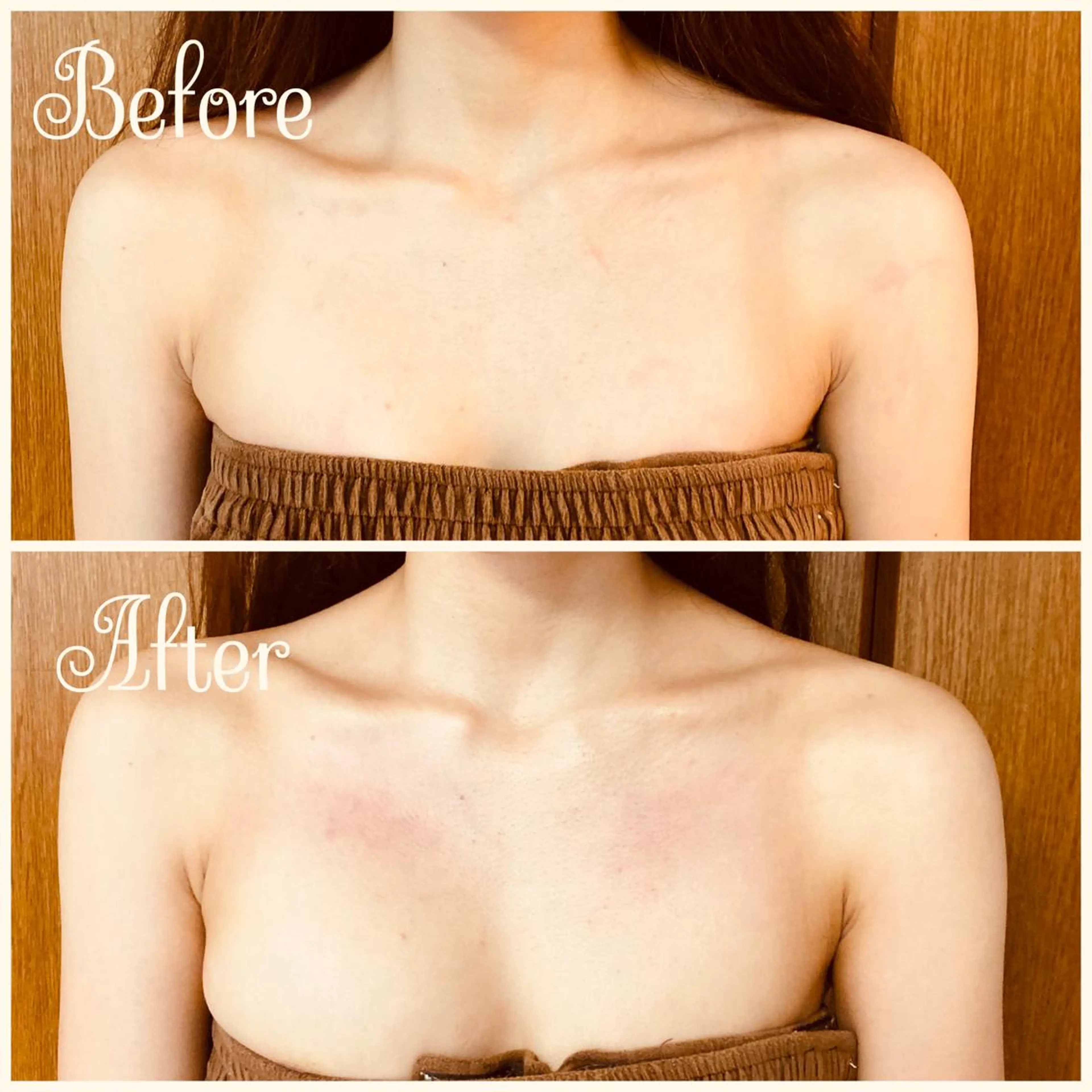 エステ リラク Linomalie エステ/たるみ/脱毛のエステ・リラクイメージ