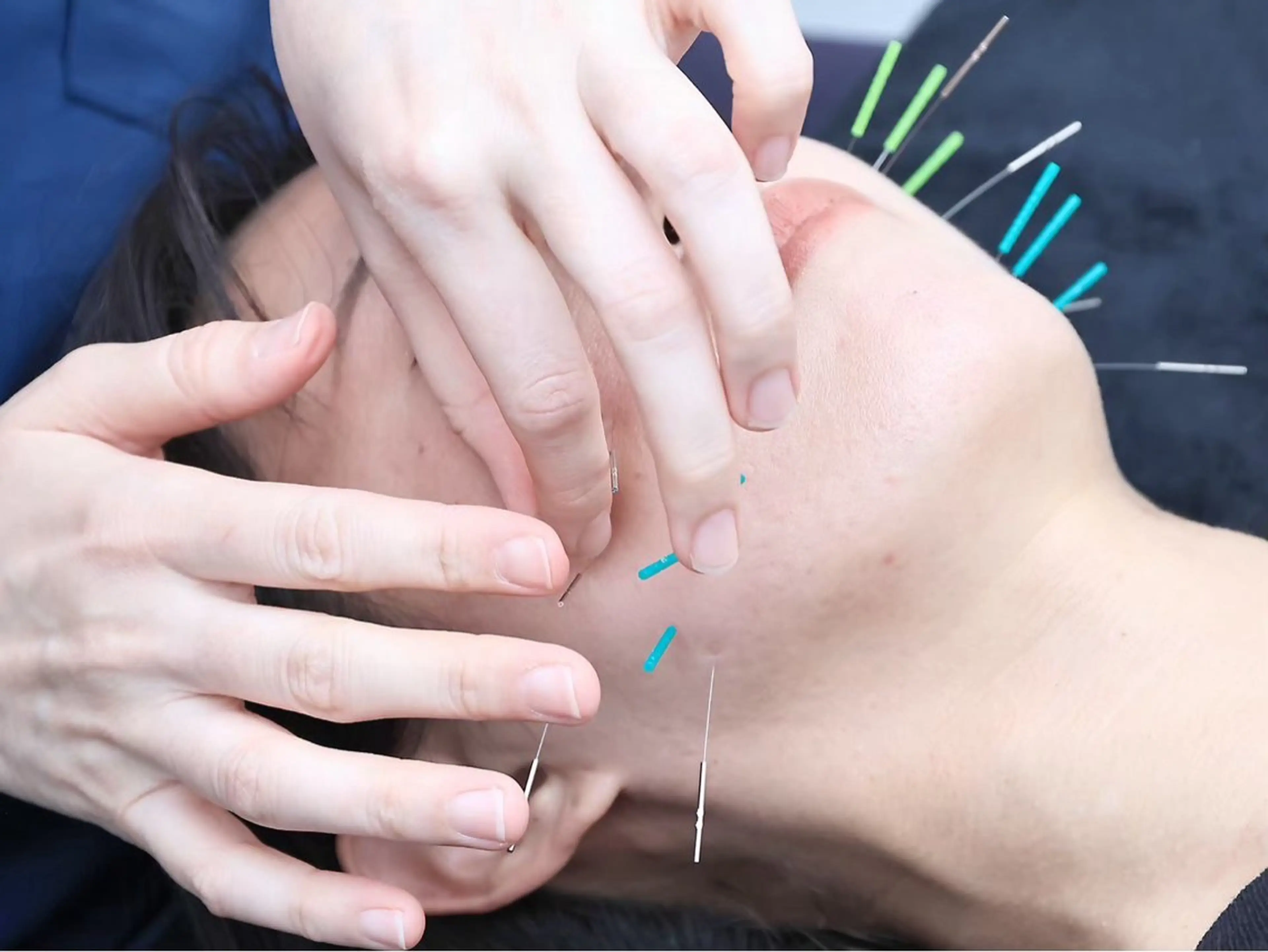 小顔矯正・美容鍼 FLOW鍼灸整体院のエステ・リラクイメージ