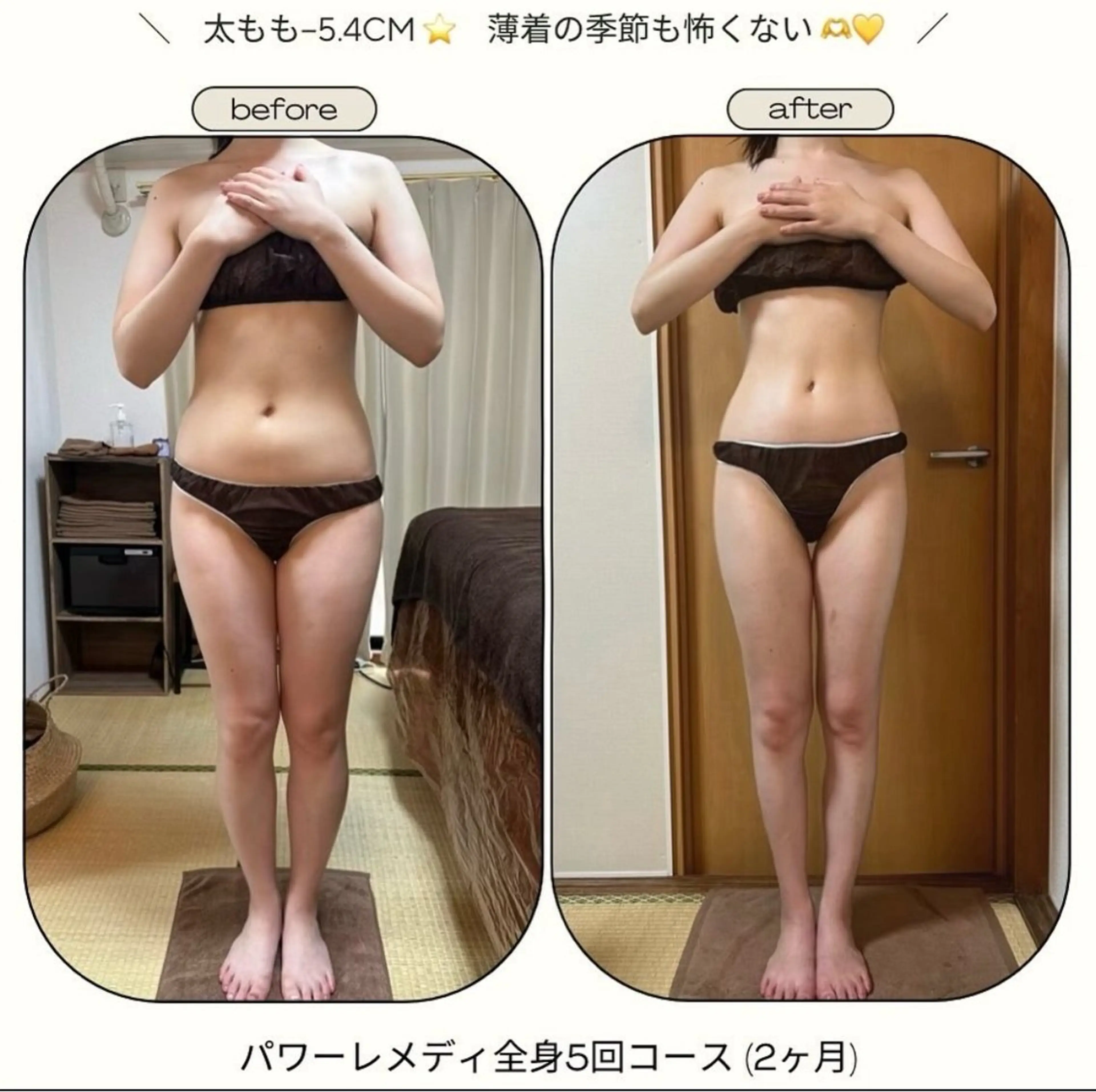 《本気痩せ×疲労改善 》  BILOOPのエステ・リラクイメージ