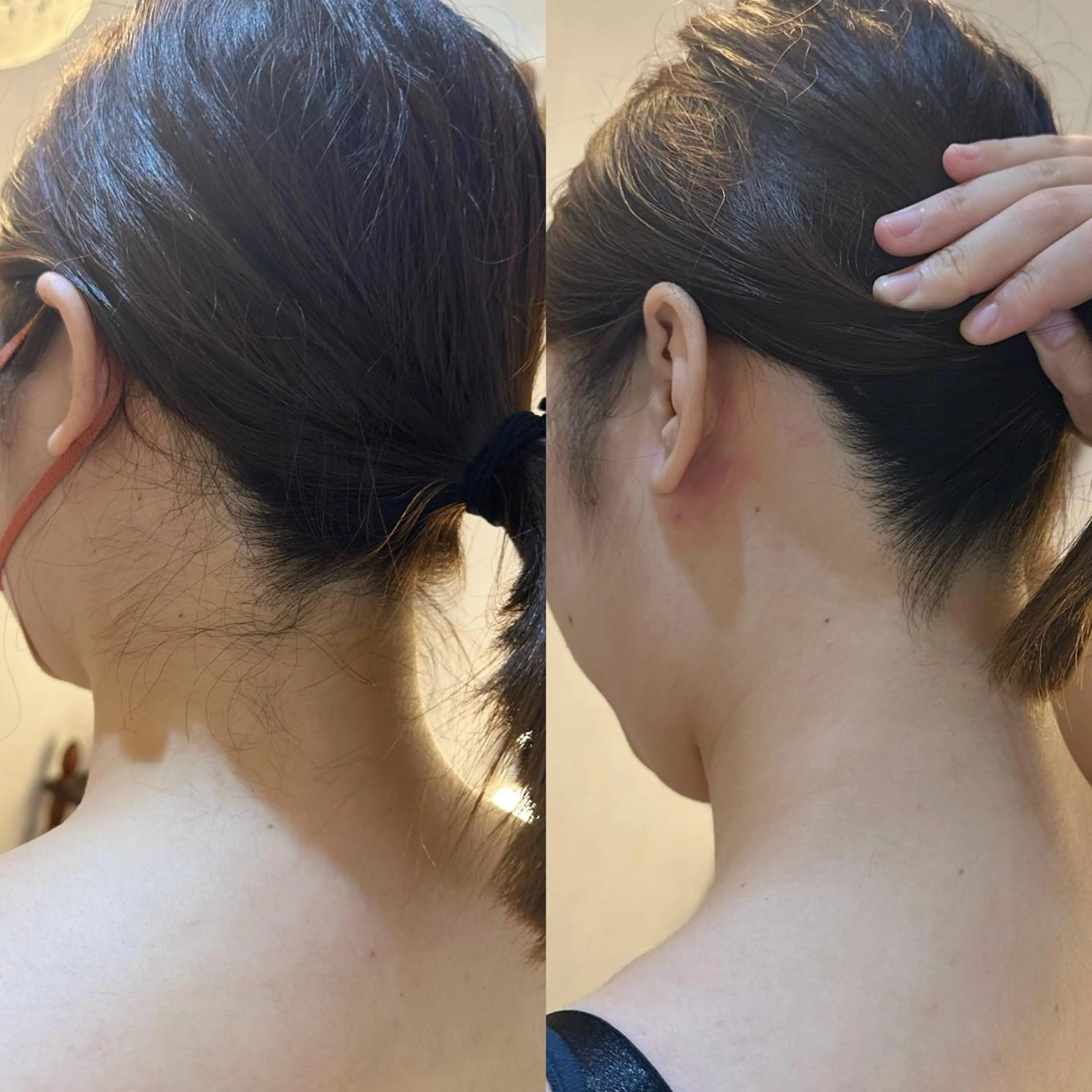 うなじ脱毛/美肌脱毛 LABELのエステ・リラクイメージ