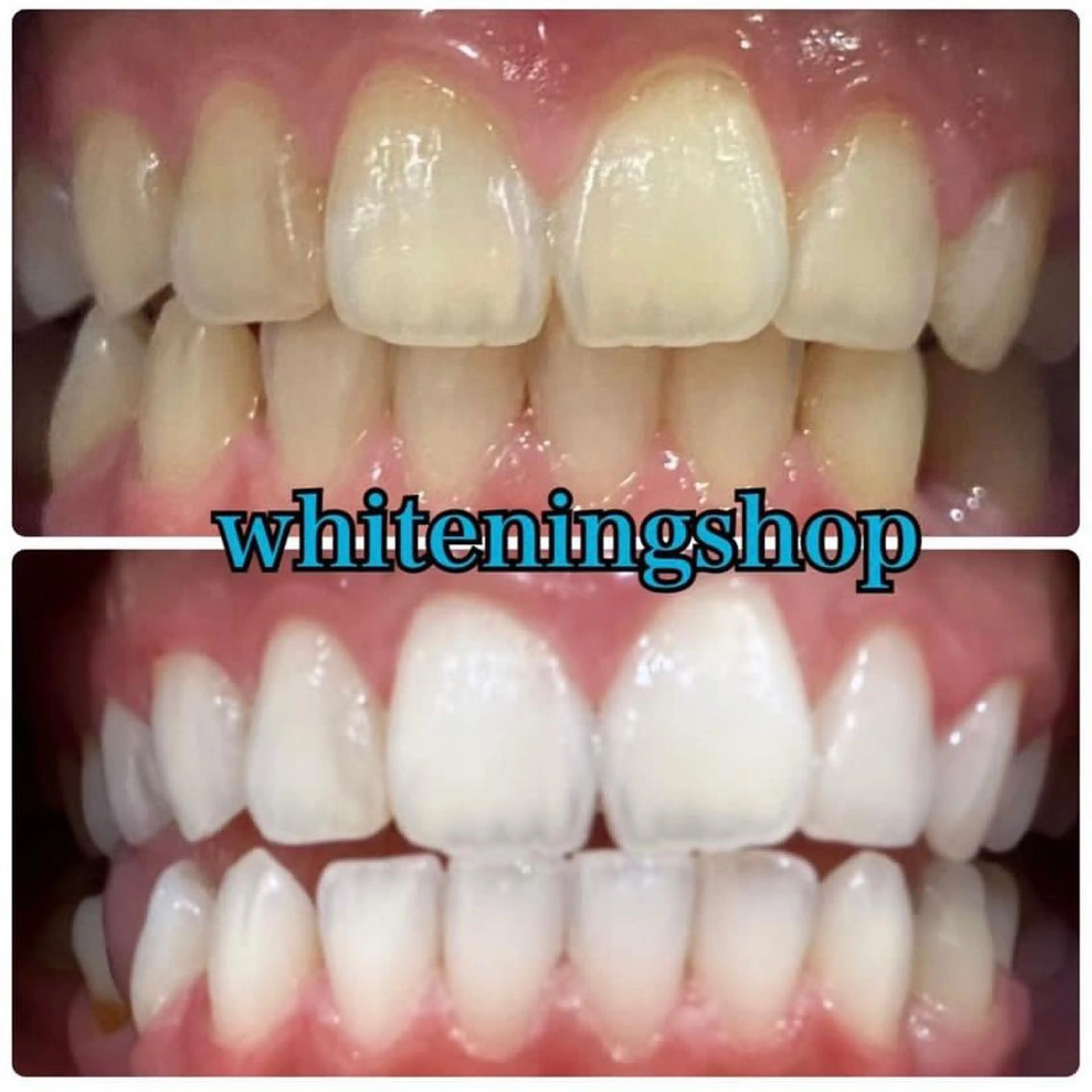 ホワイトニング ショップ吉祥寺店のエステ・リラクイメージ