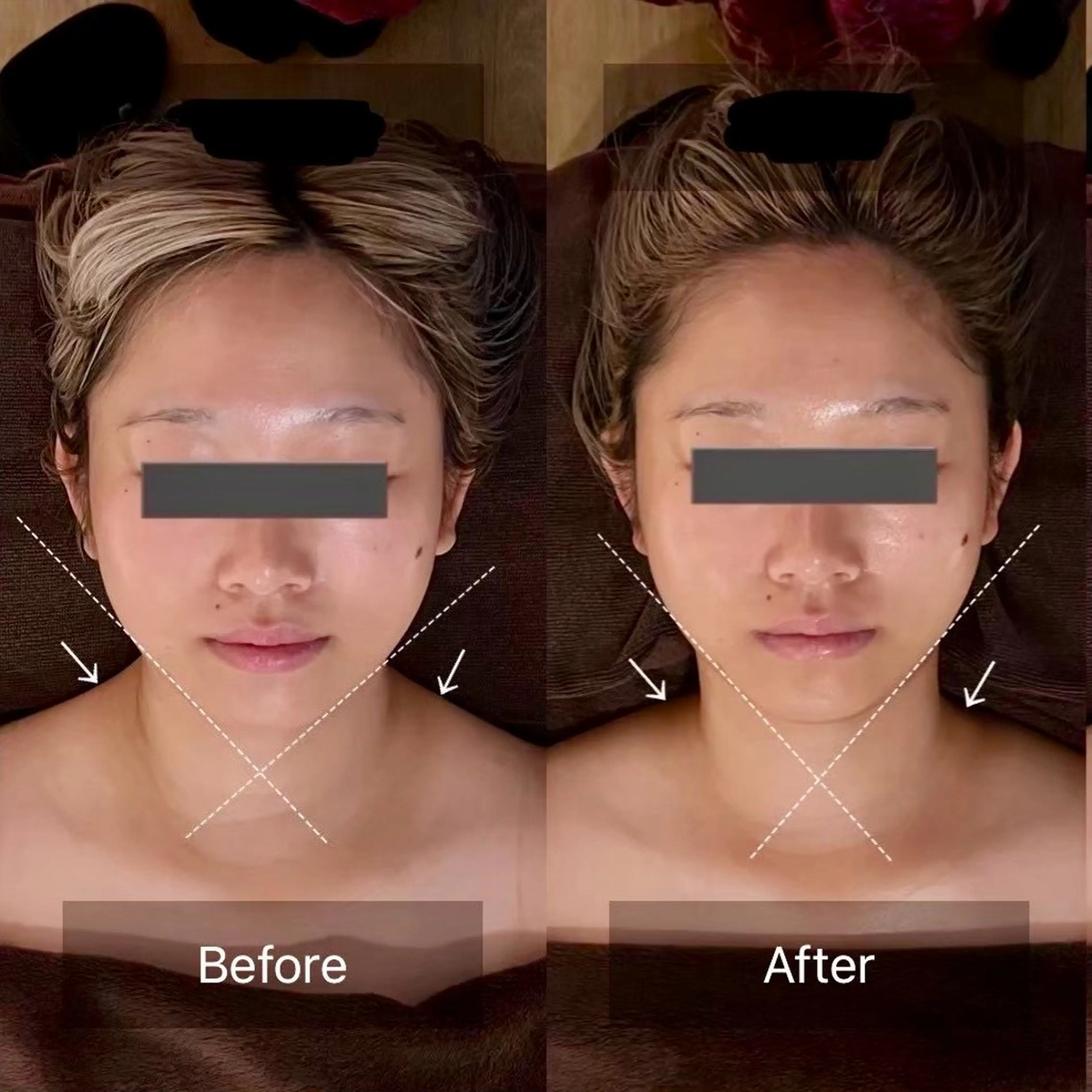 エステ リラク kogao&head Linoasのエステ・リラクイメージ