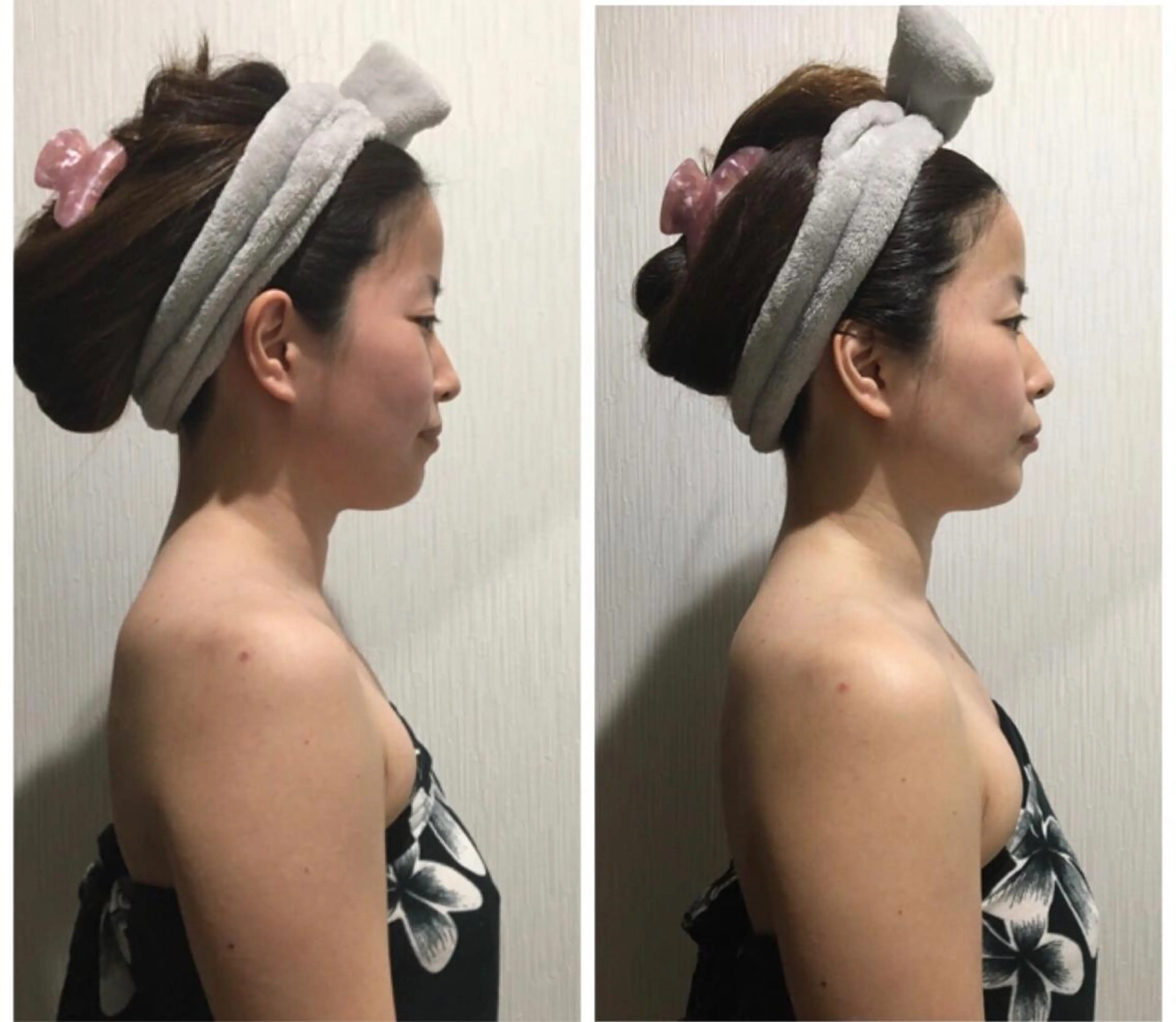 和歌山で当店のみ💎DDフェイシャル✨デトックス小顔＋ドレナージュ美肌💓未体験の小顔,美肌と癒し✨毛穴ケア,骨格矯正✨の写真